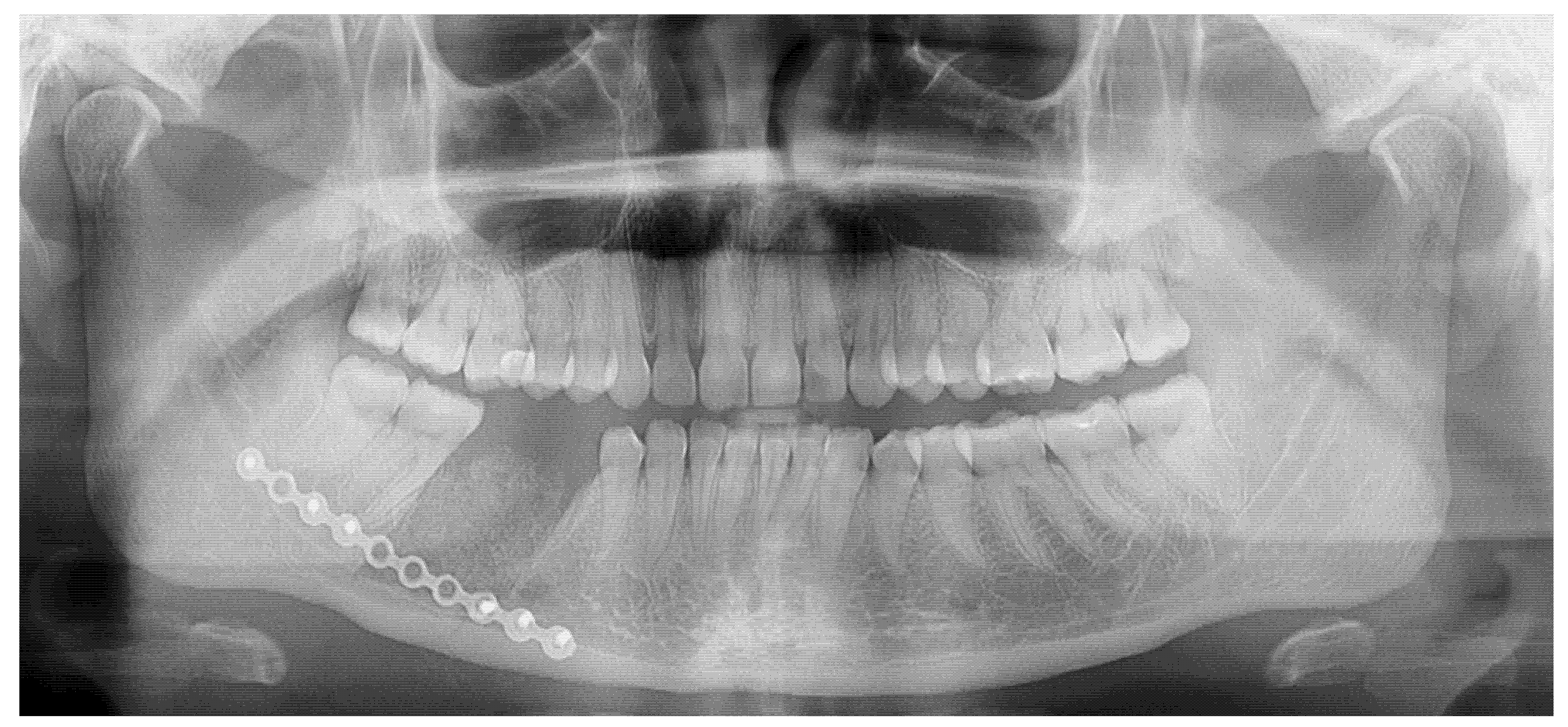 Diagnostics 15 01367 g005
