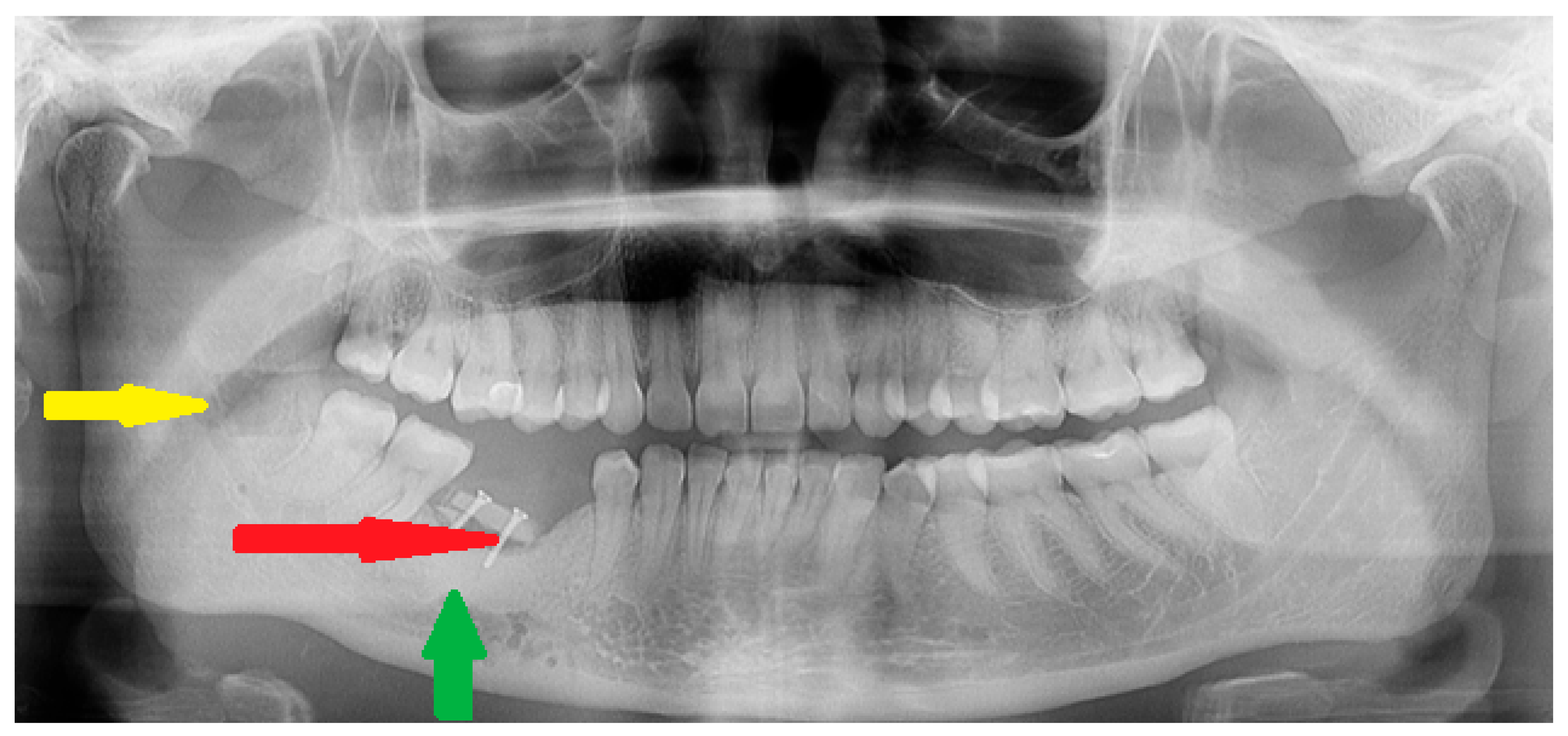Diagnostics 15 01367 g006