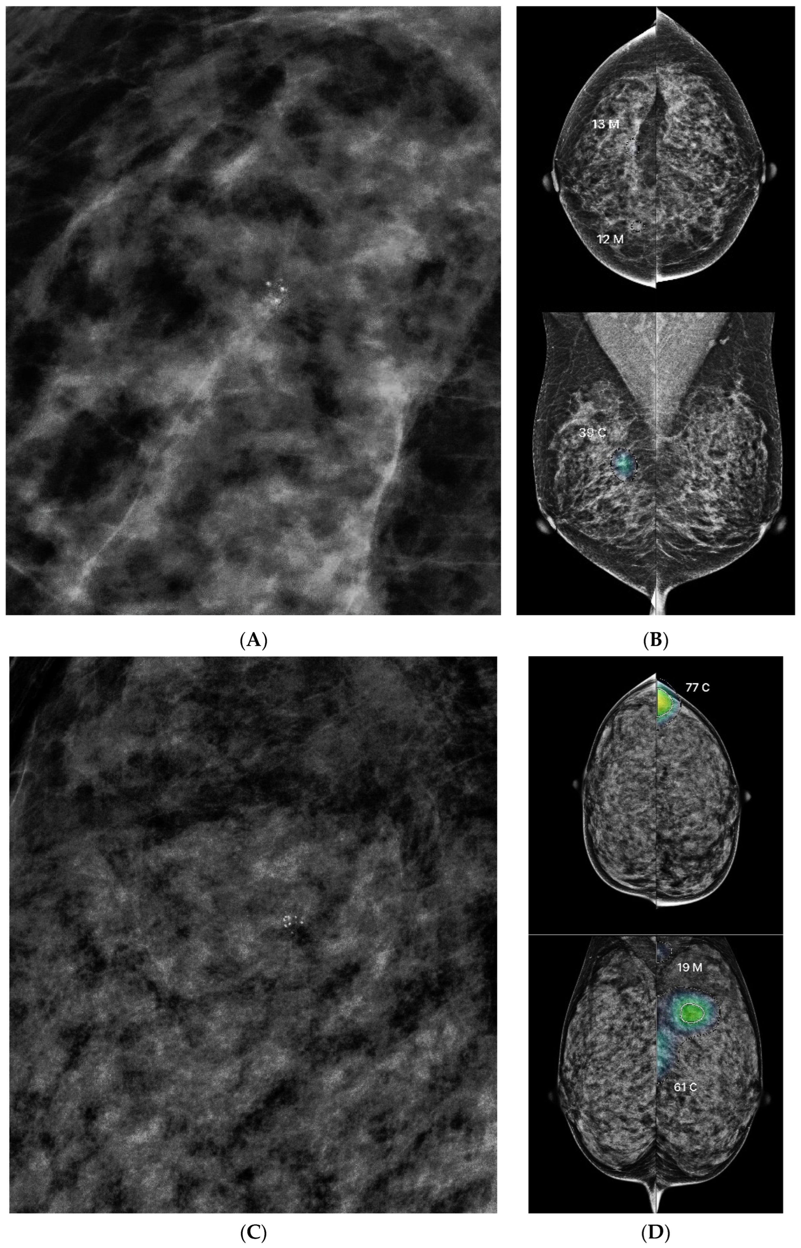 Diagnostics 15 01368 g004