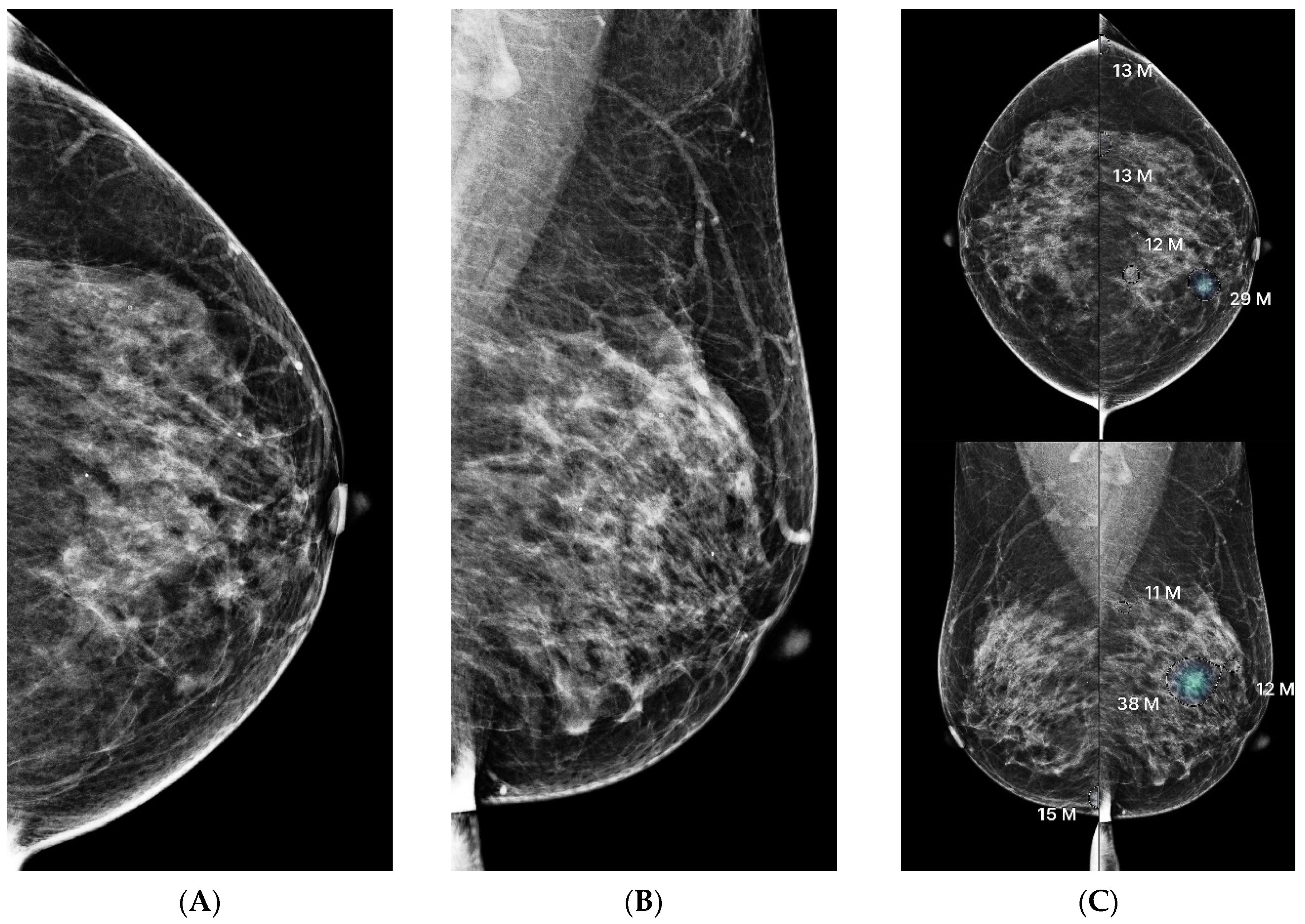 Diagnostics 15 01368 g005