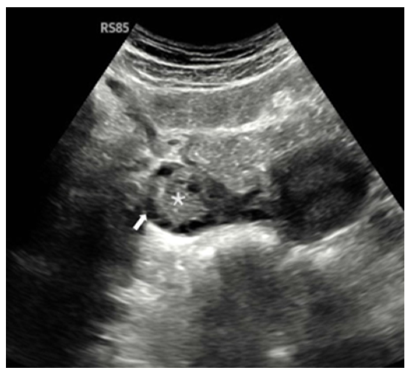 Diagnostics 15 01376 g002