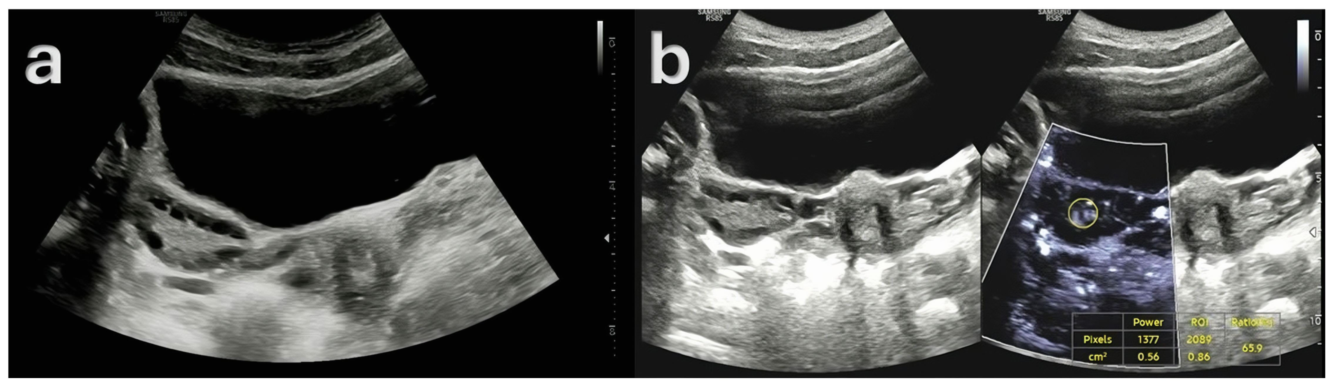 Diagnostics 15 01376 g003