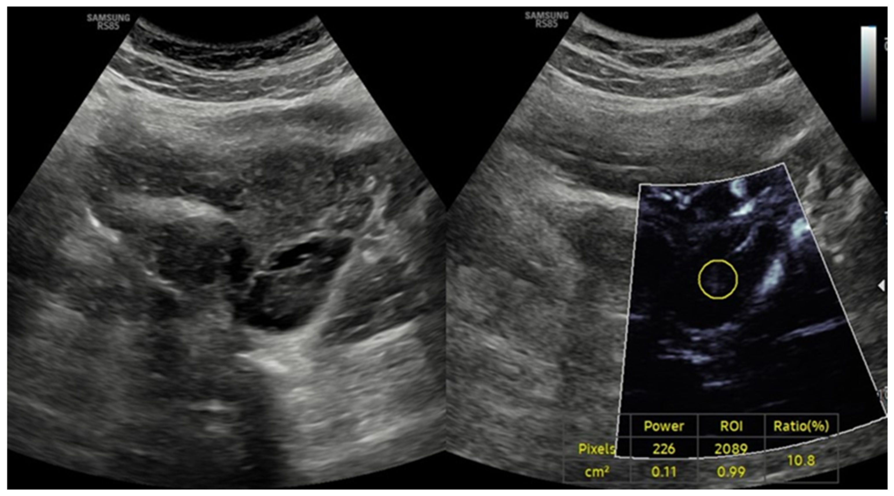 Diagnostics 15 01376 g004