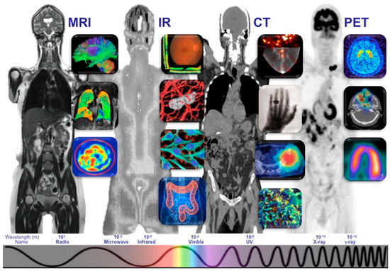 Integrating Radiogenomics and Machine Learning in Musculoskeletal ...