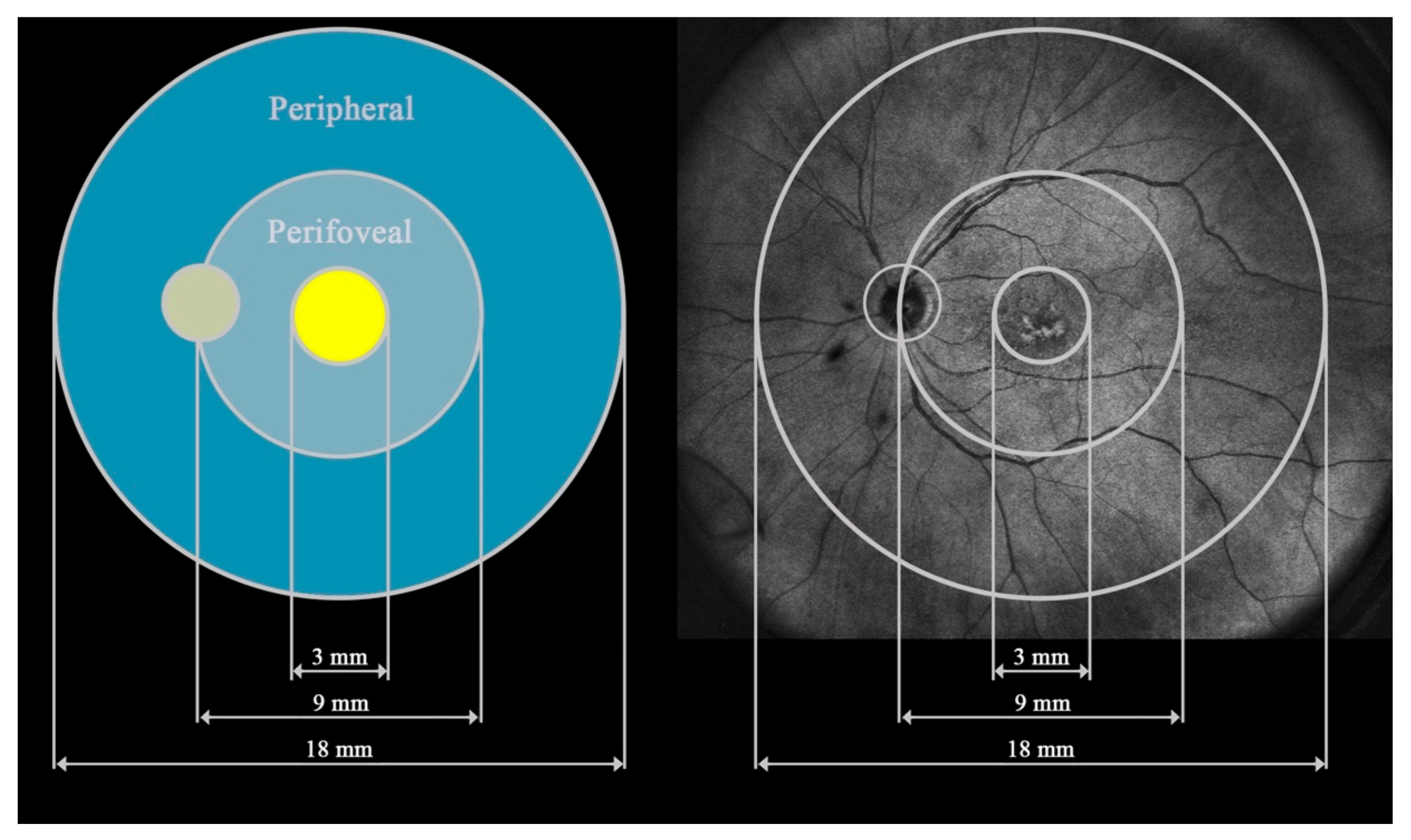 Diagnostics 15 01382 g001