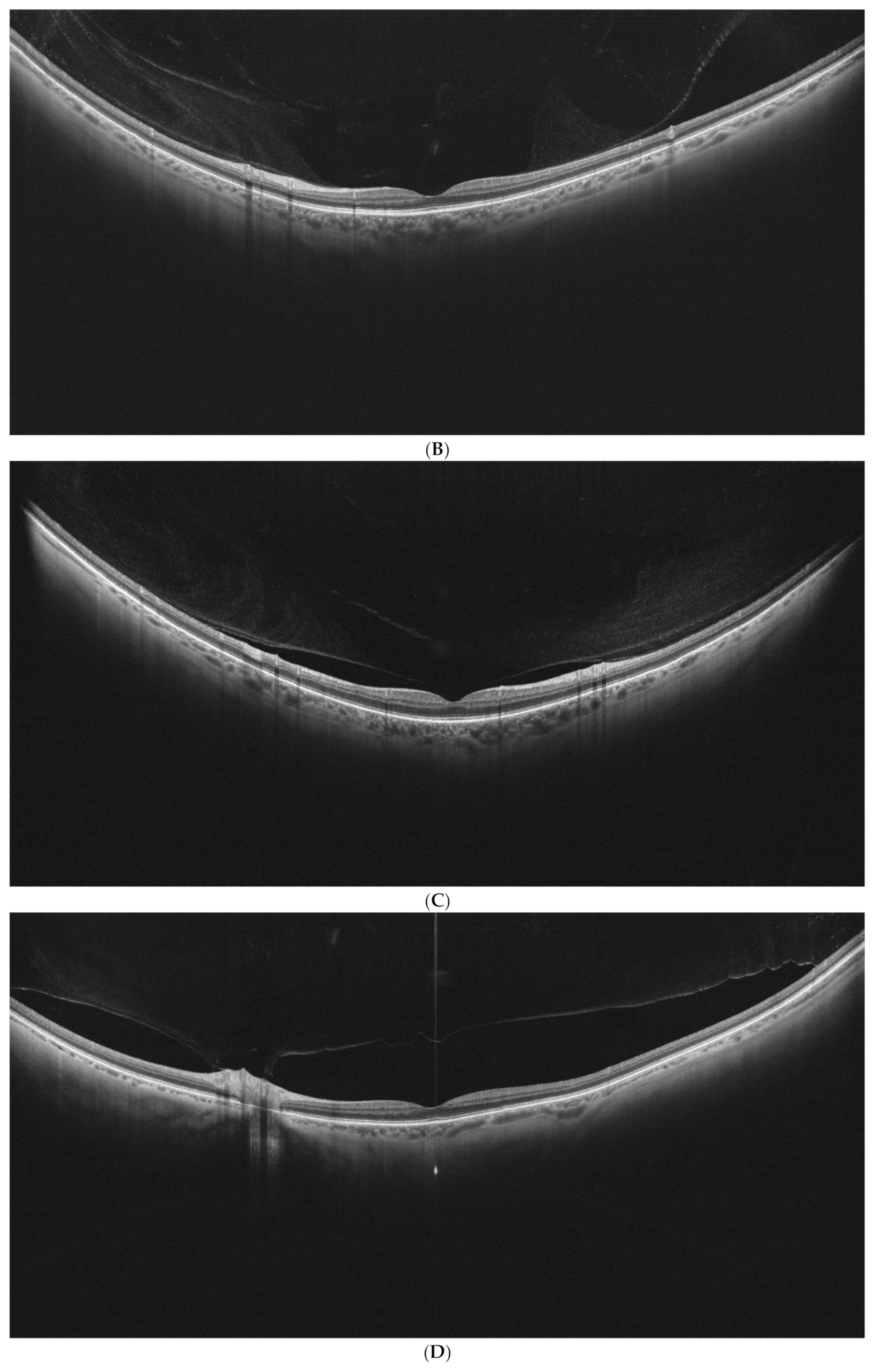 Diagnostics 15 01382 g002b