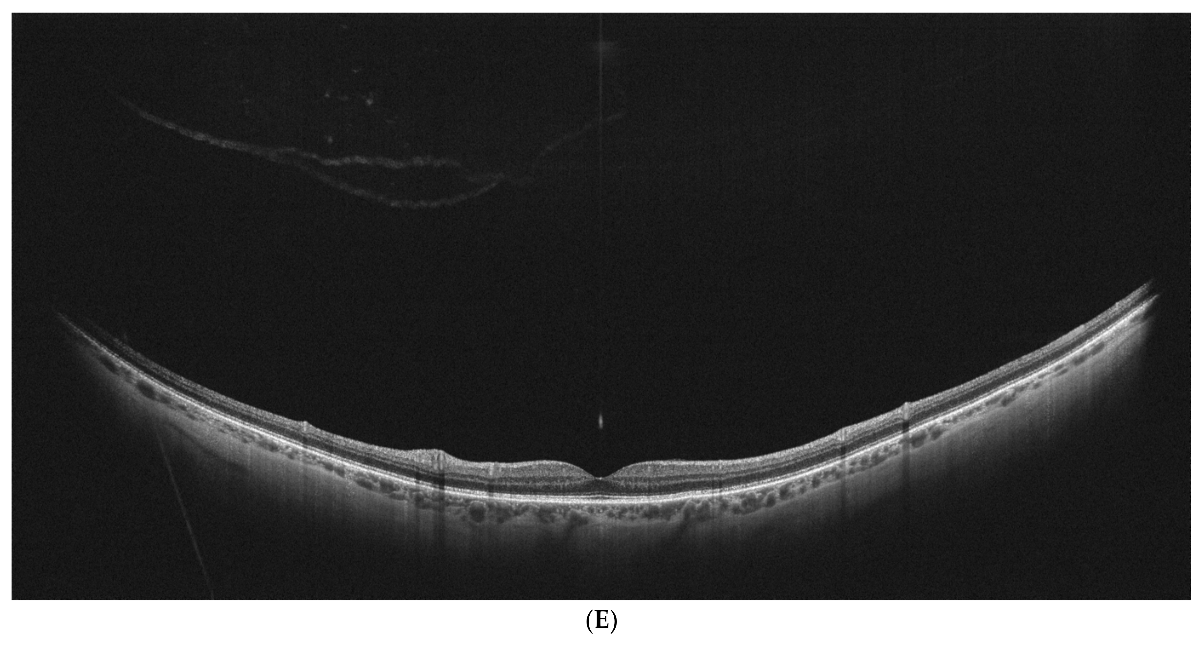 Diagnostics 15 01382 g002c
