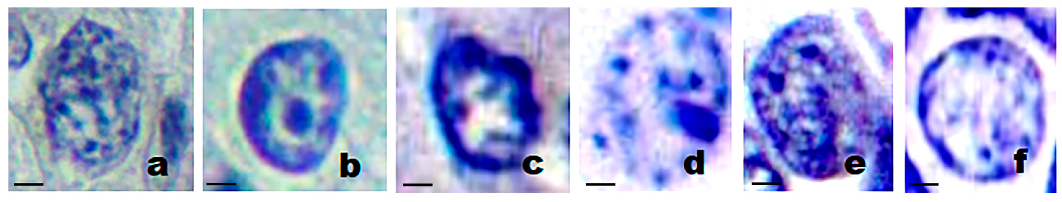 Diagnostics 15 01389 g002