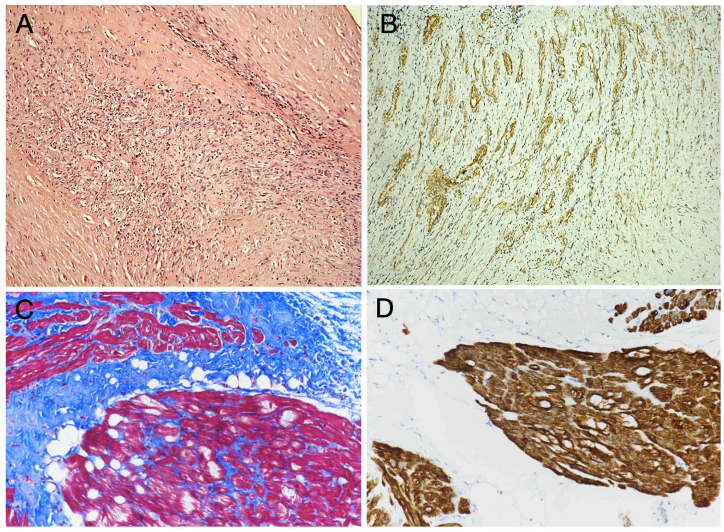 Diagnostics 15 01390 g002