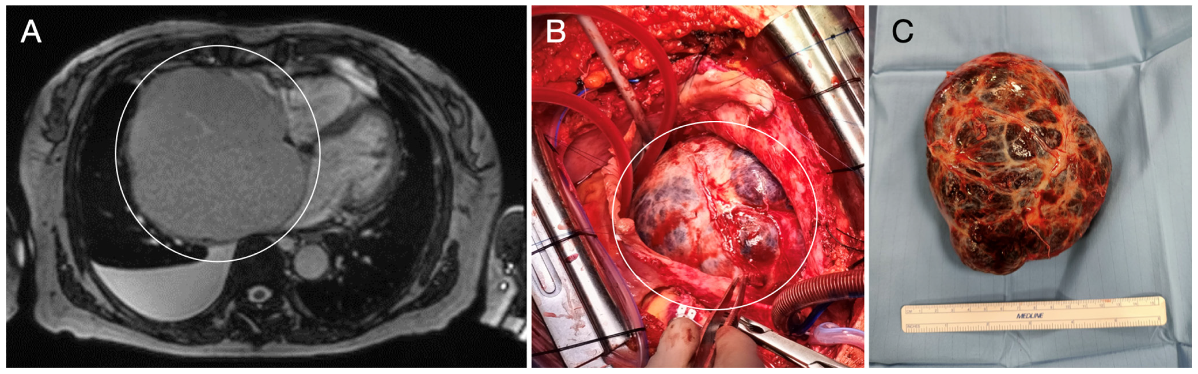 Diagnostics 15 01390 g006