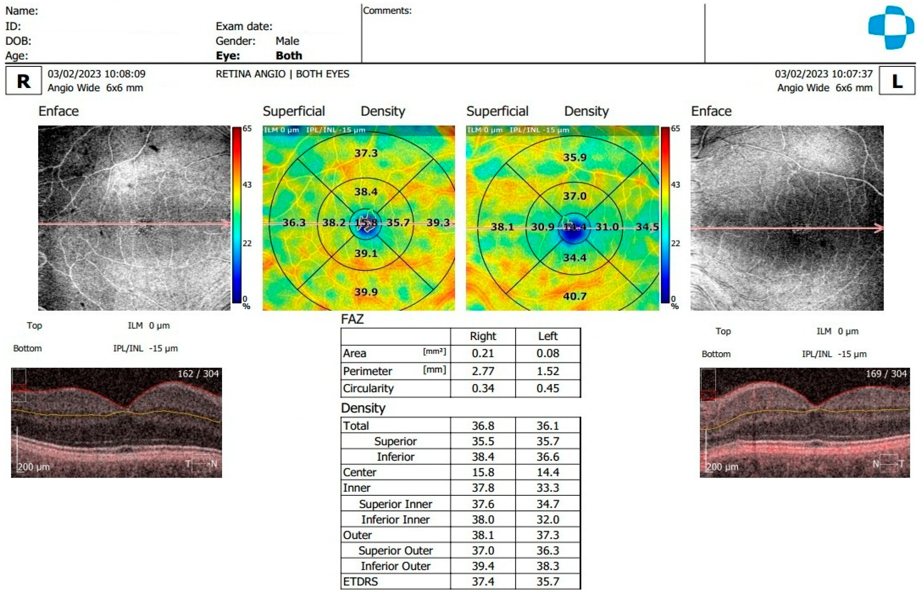Diagnostics 15 01393 g001