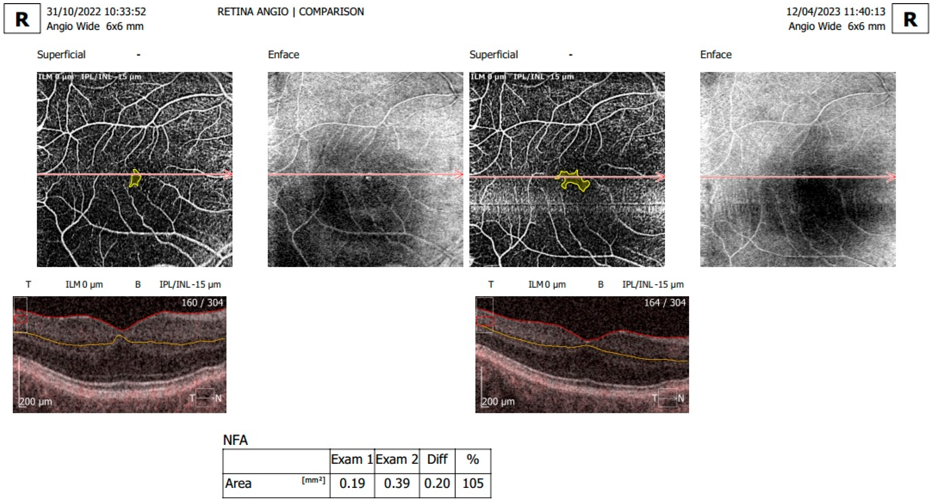 Diagnostics 15 01393 g002