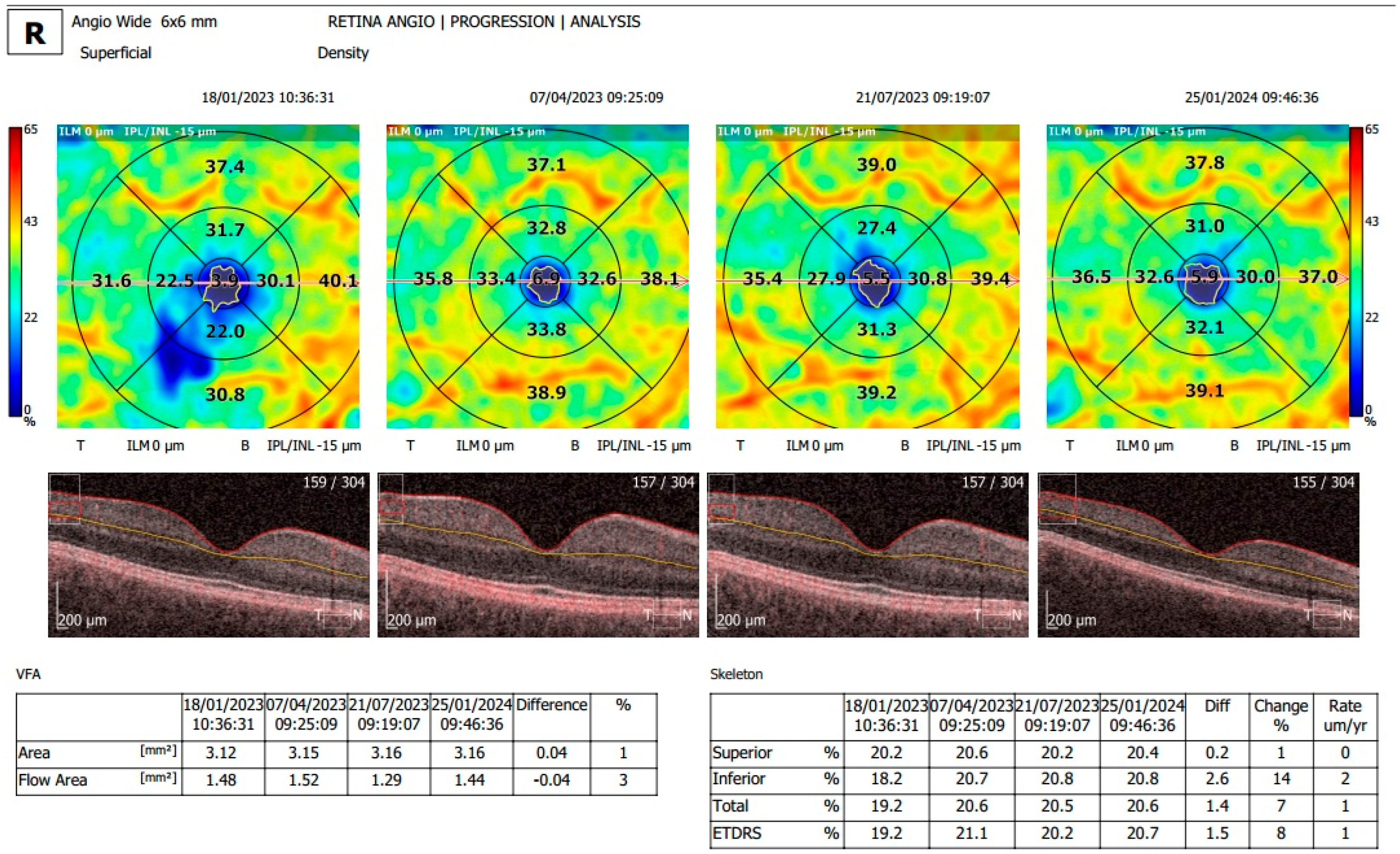 Diagnostics 15 01393 g003