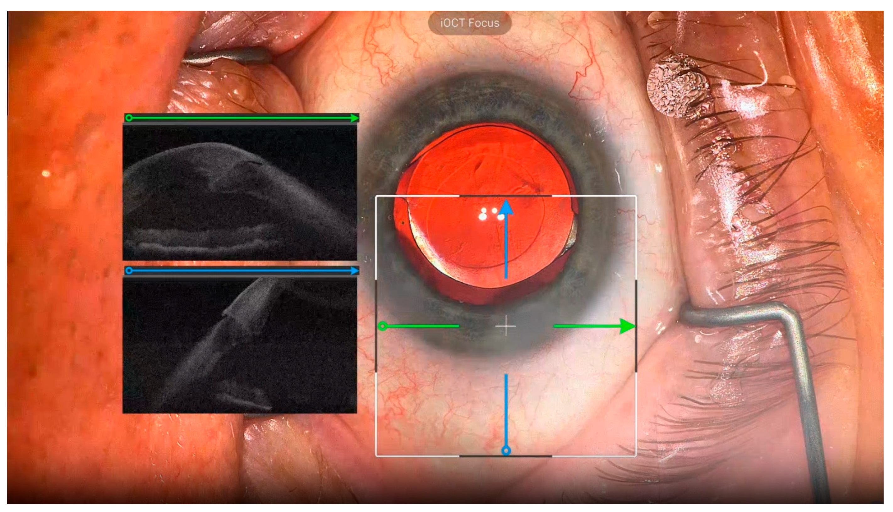 Diagnostics 15 01394 g003