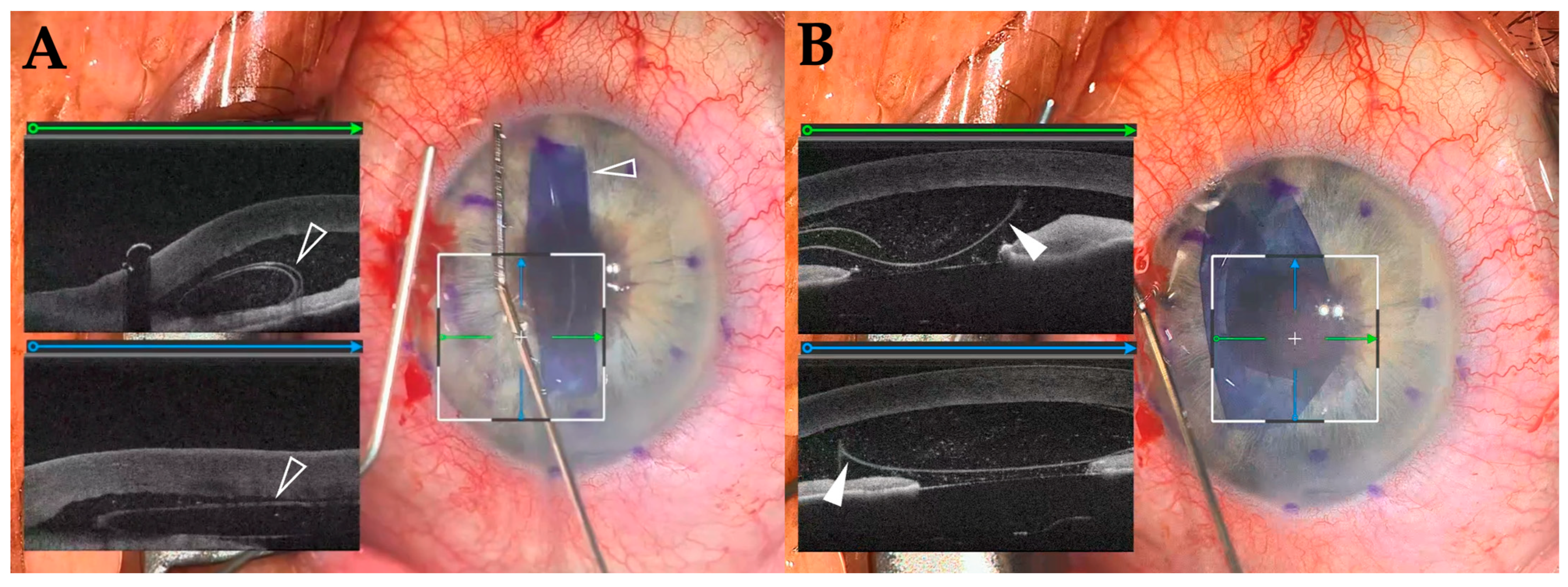 Diagnostics 15 01394 g004