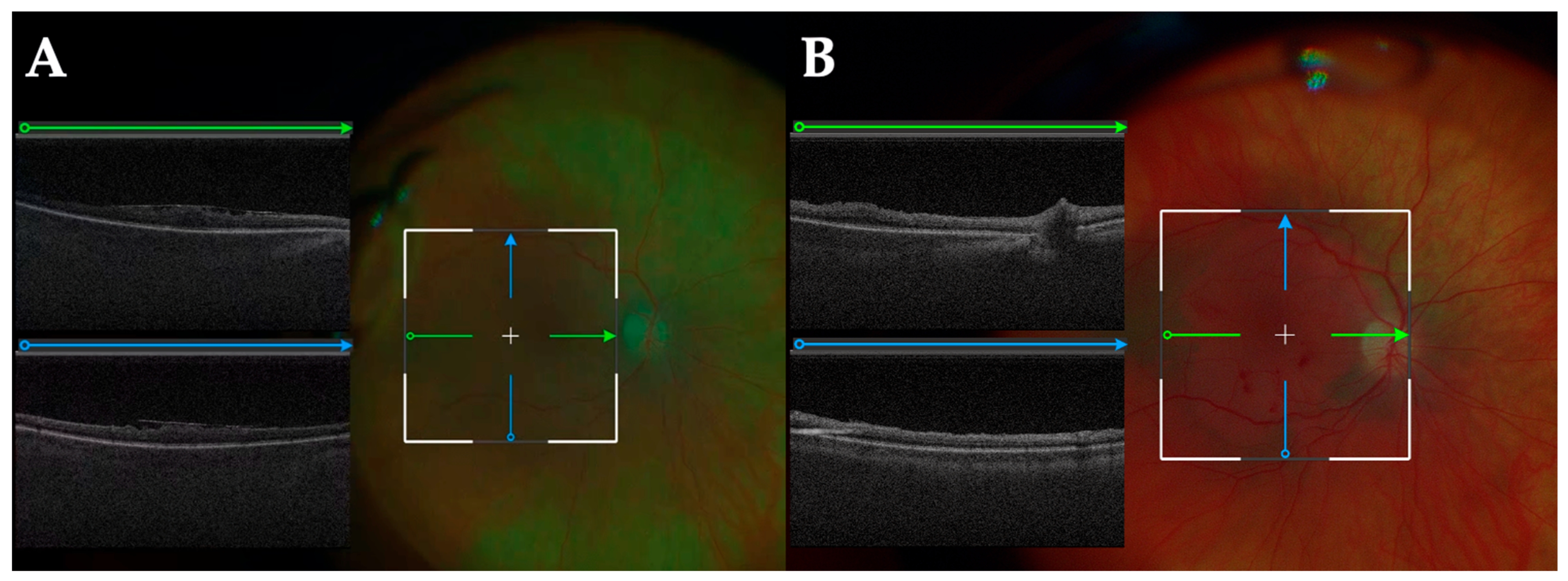 Diagnostics 15 01394 g005