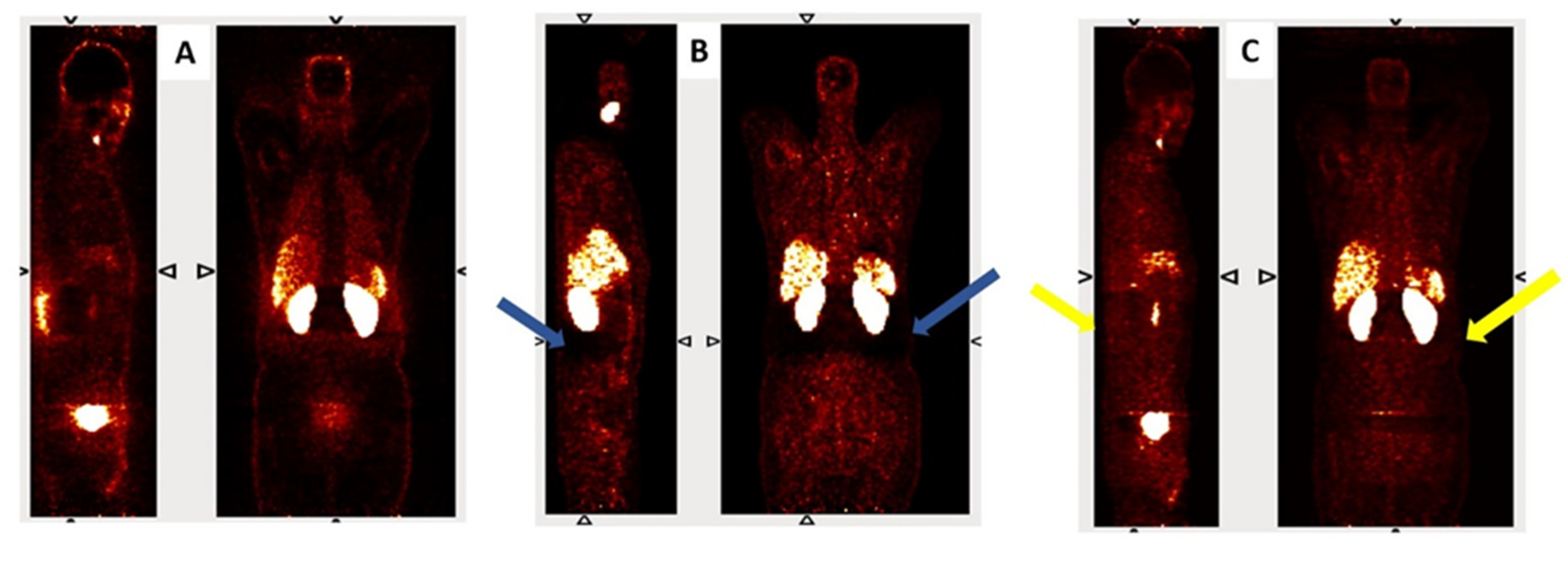 Diagnostics 15 01400 g002