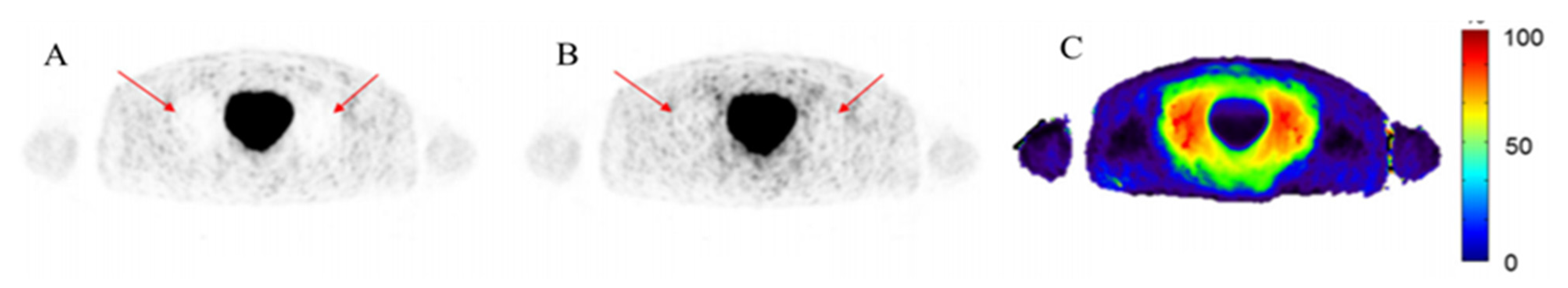 Diagnostics 15 01400 g005