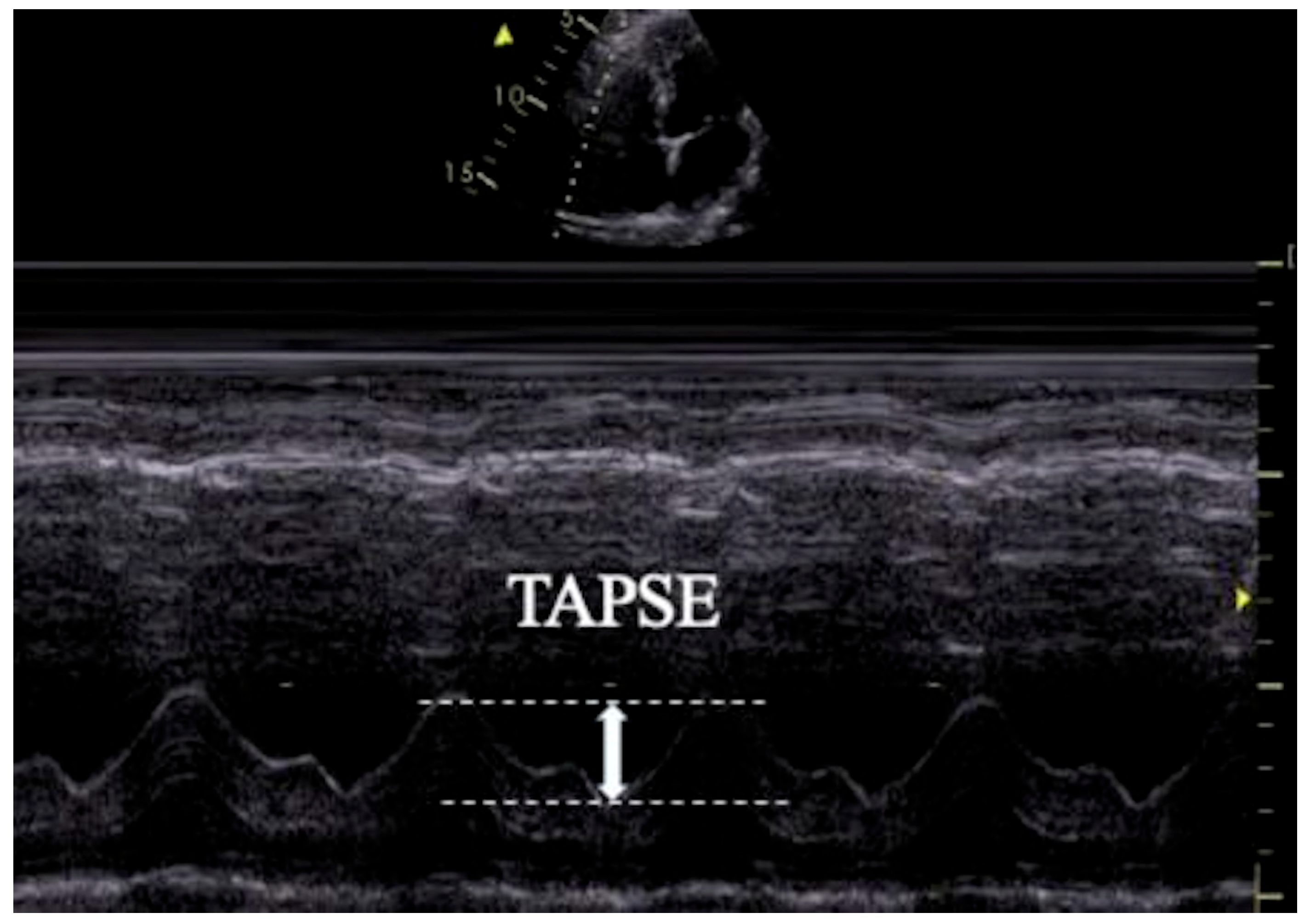 Diagnostics 15 01404 g001