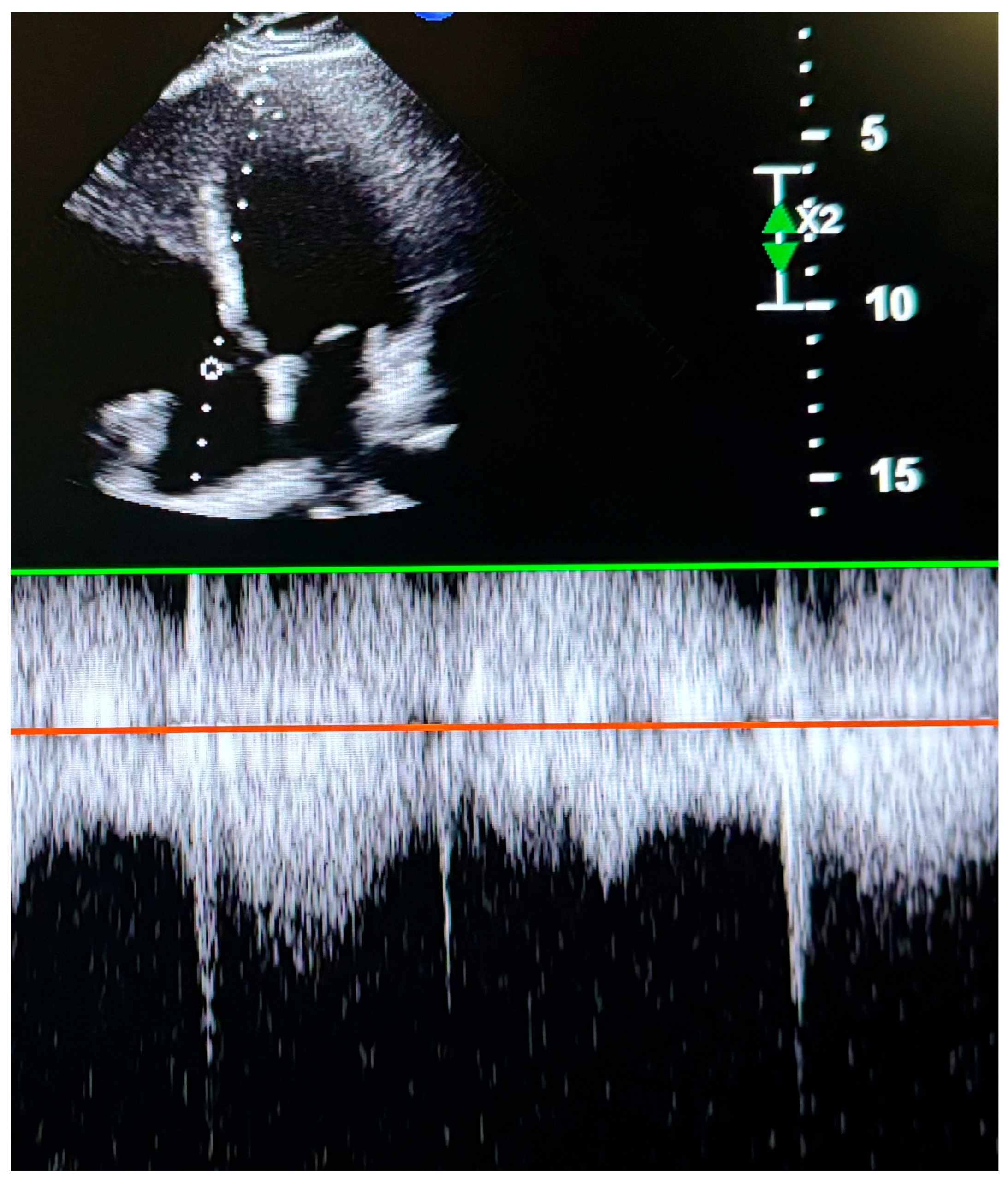 Diagnostics 15 01404 g002