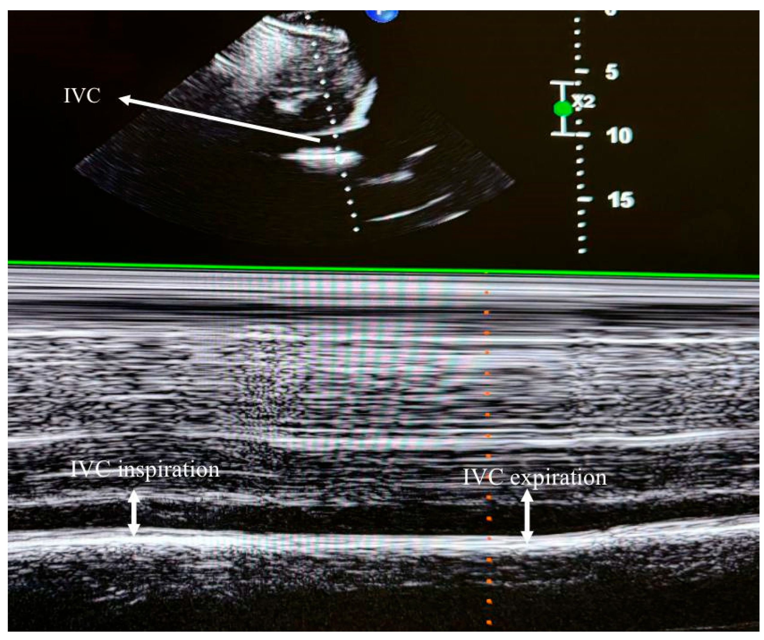 Diagnostics 15 01404 g003