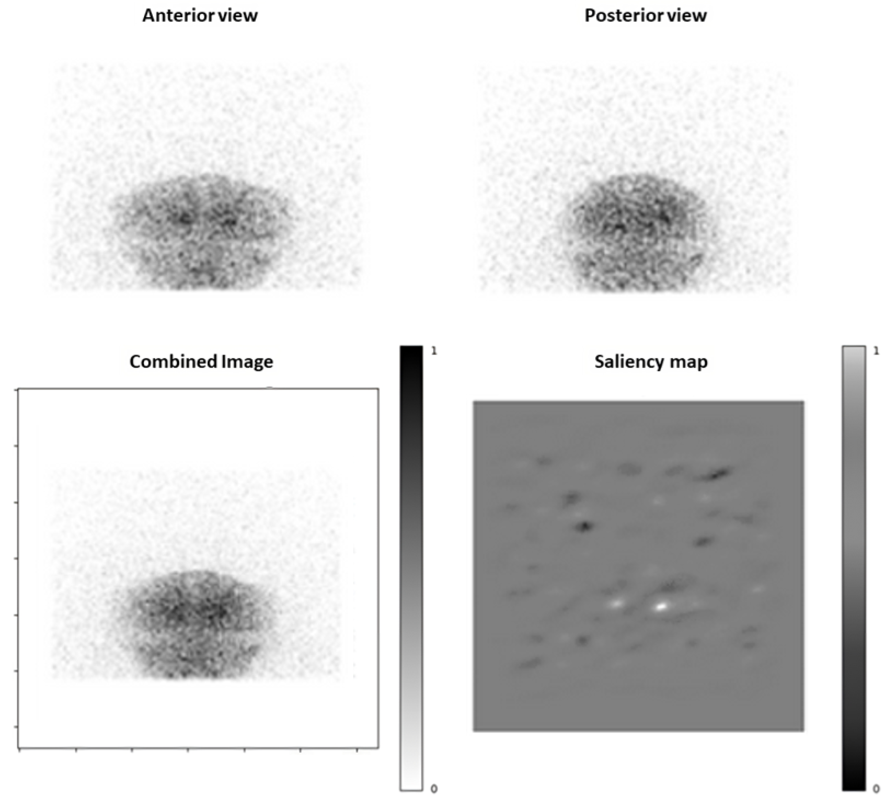 Diagnostics 15 01407 g005