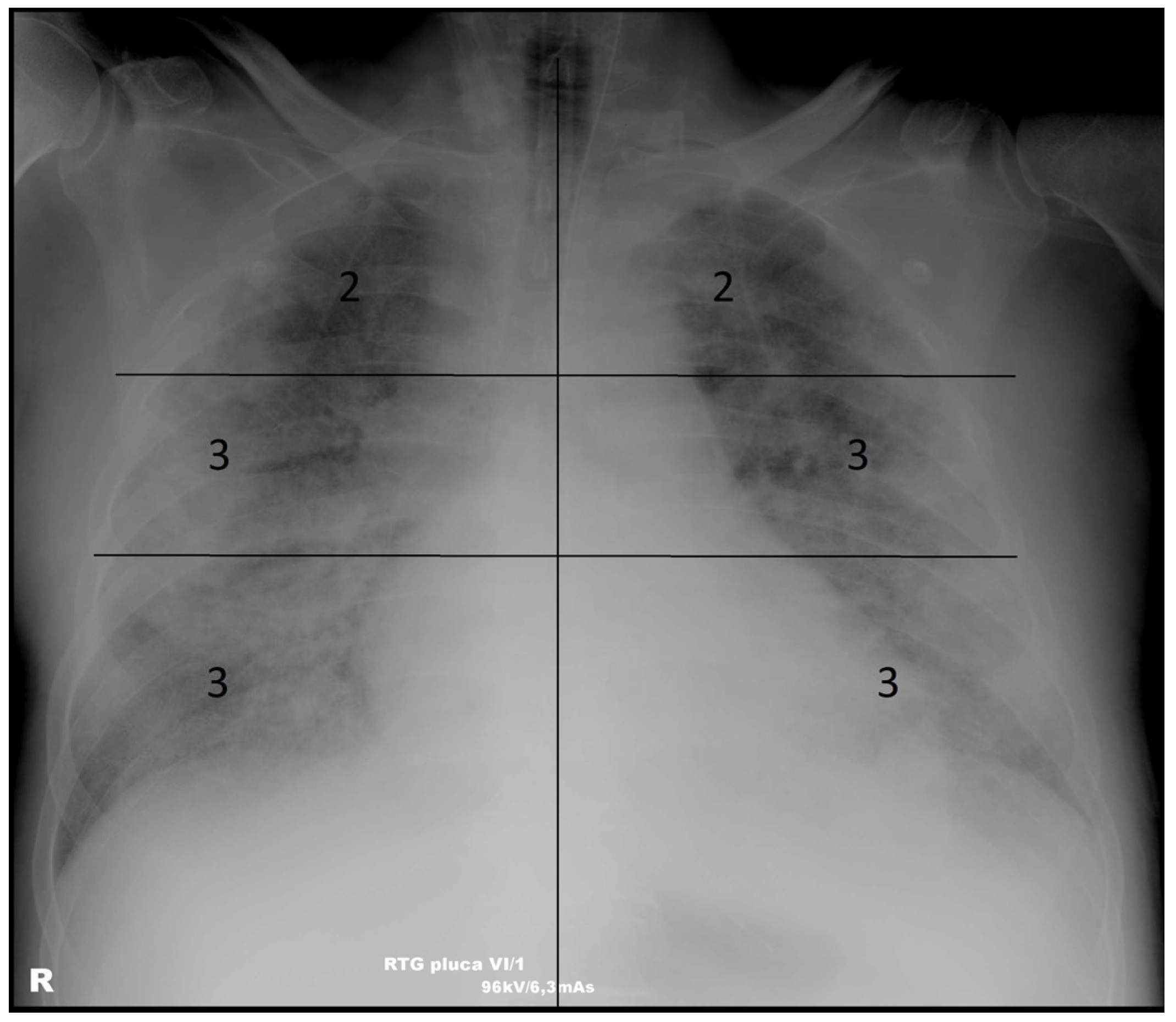 Diagnostics 15 01409 g002