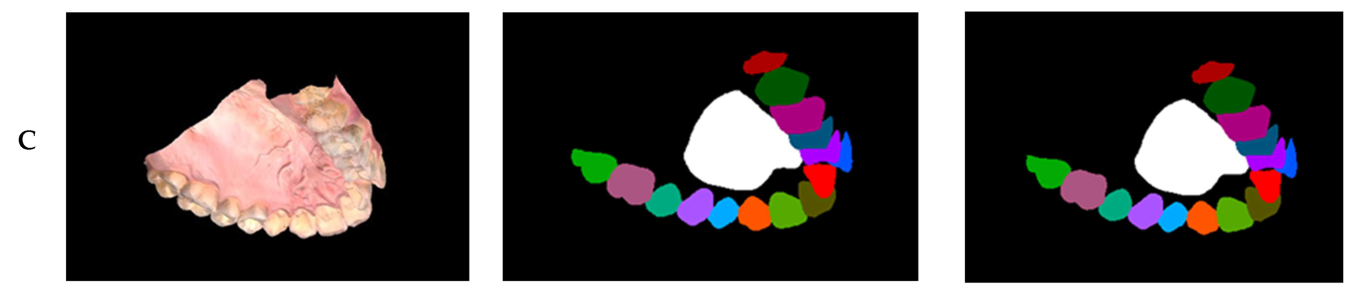 Diagnostics 15 01415 g007b