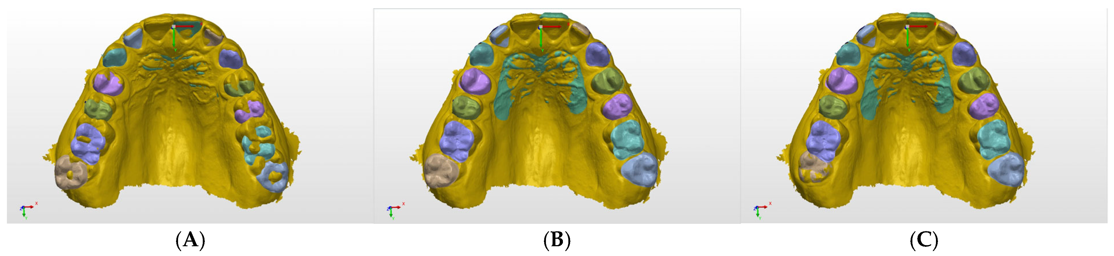 Diagnostics 15 01415 g0a2