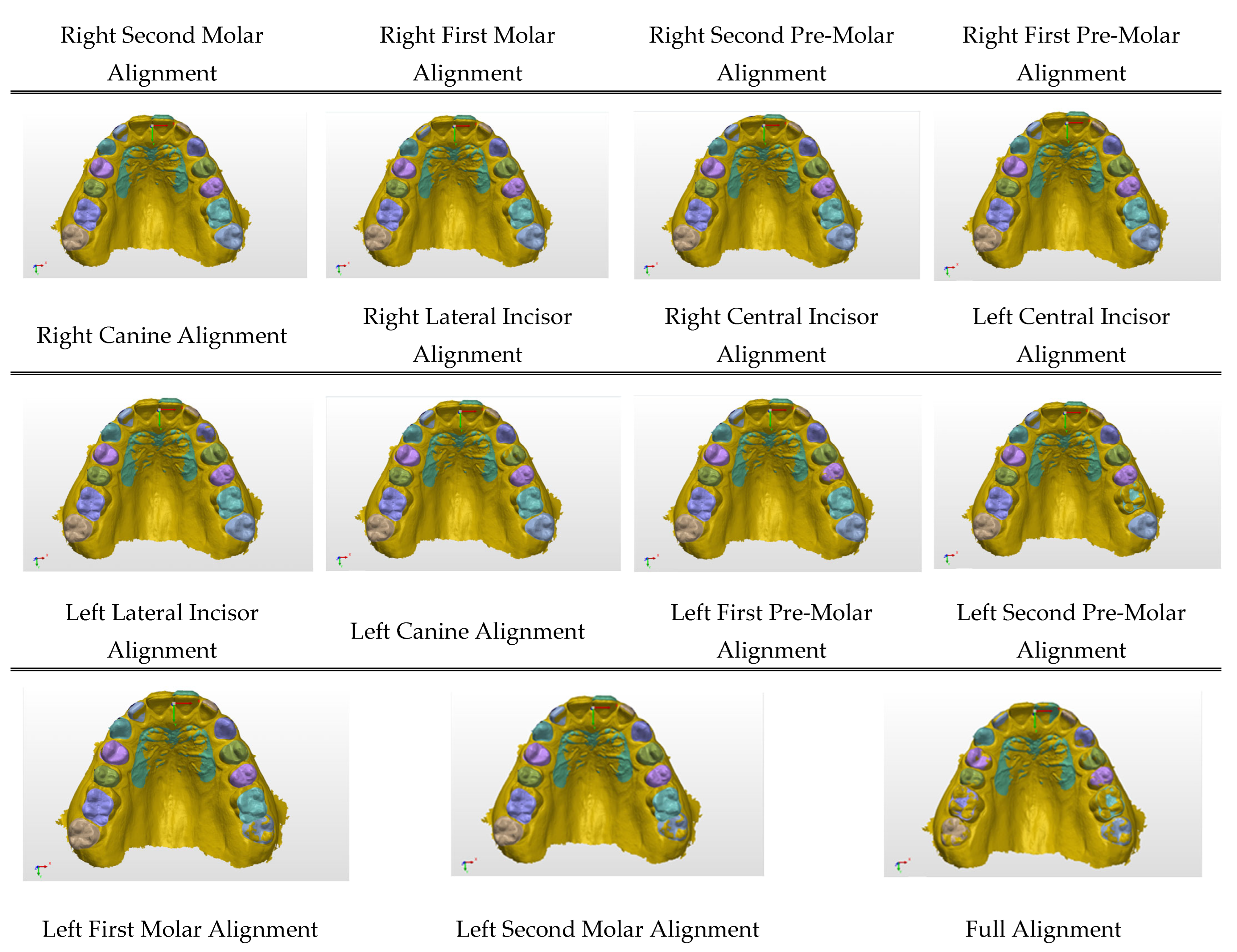 Diagnostics 15 01415 g0a4b
