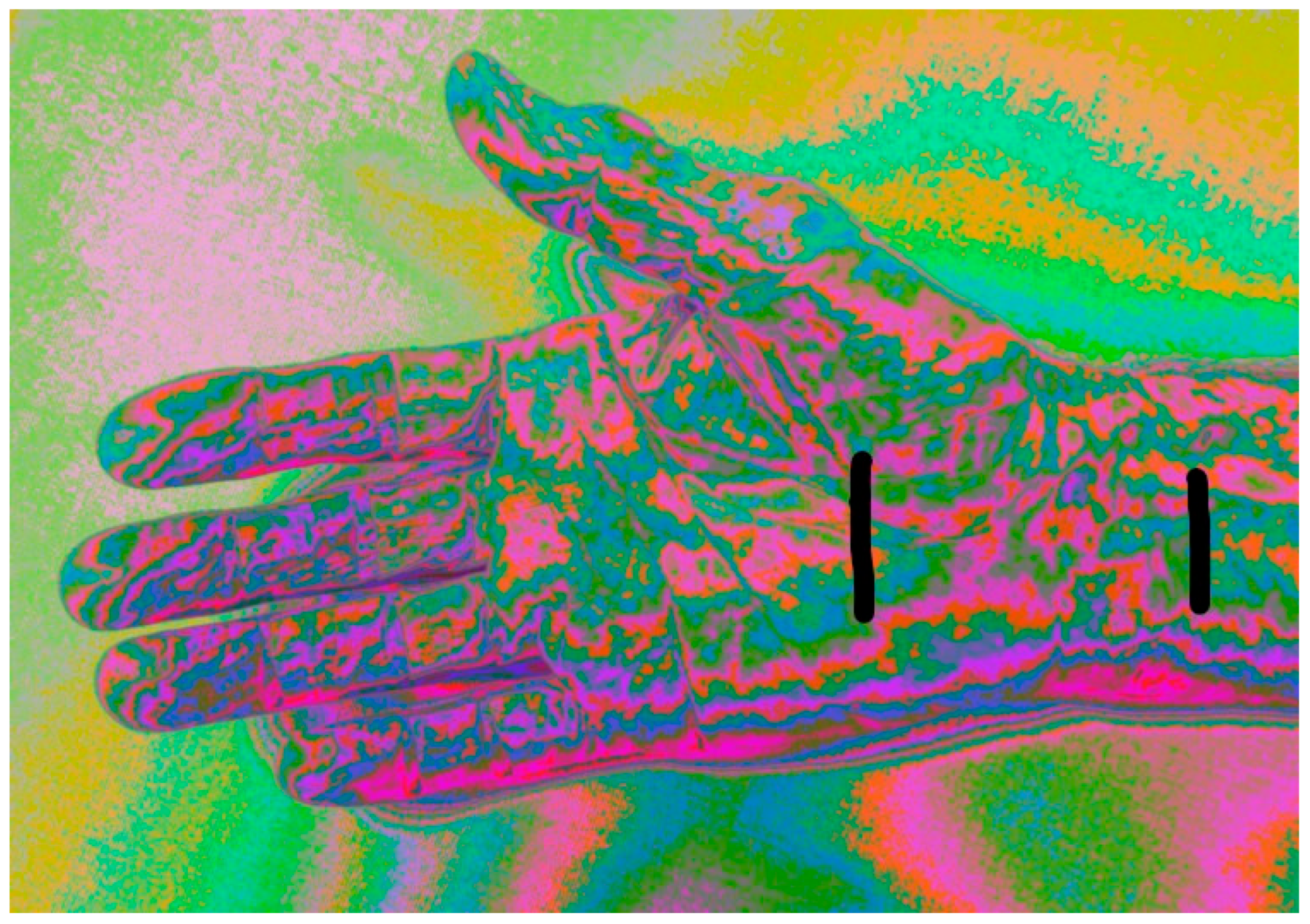 Diagnostics 15 01417 g002 Diagnostics 15 01417 g002