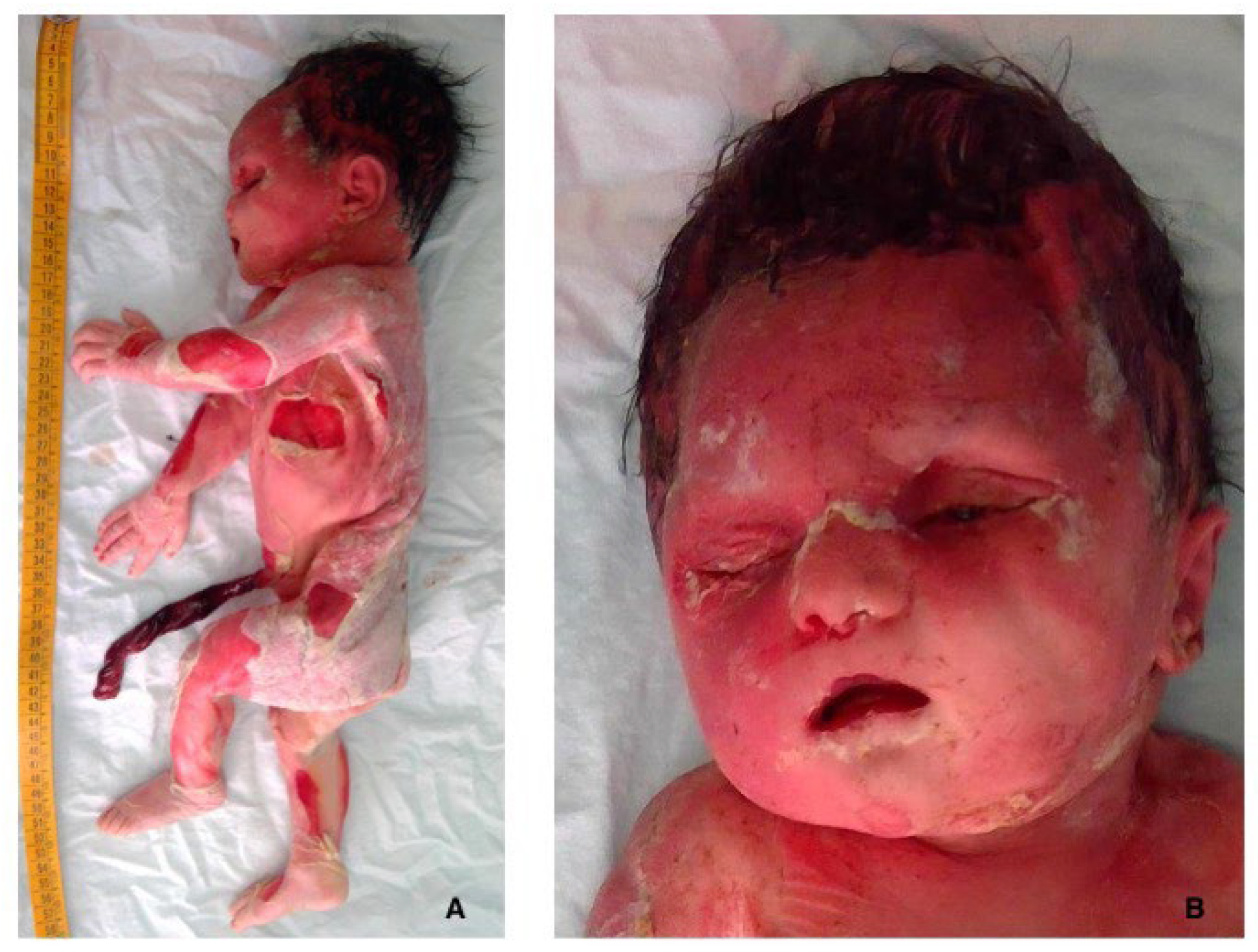 Diagnostics 15 01423 g001 Diagnostics 15 01423 g001