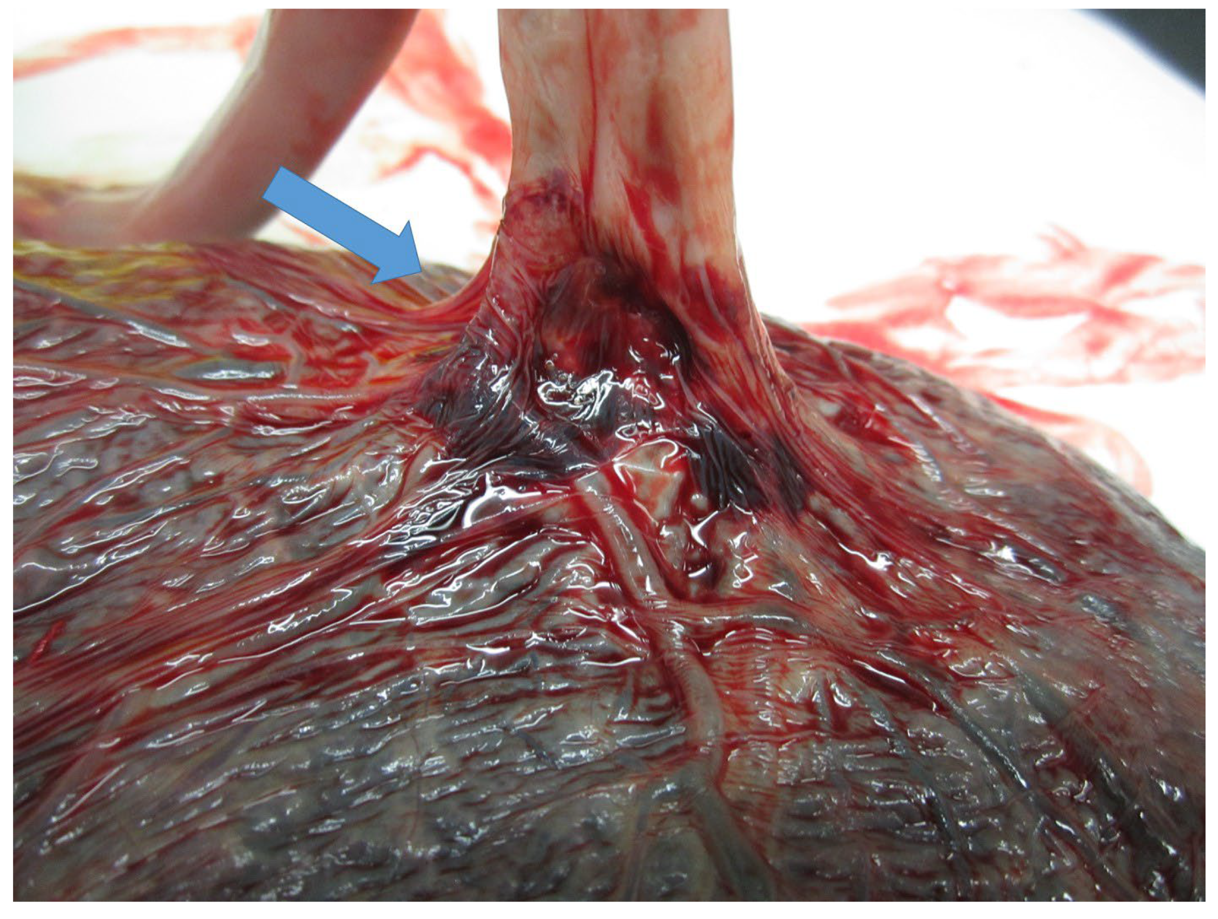 Diagnostics 15 01423 g003 Diagnostics 15 01423 g003