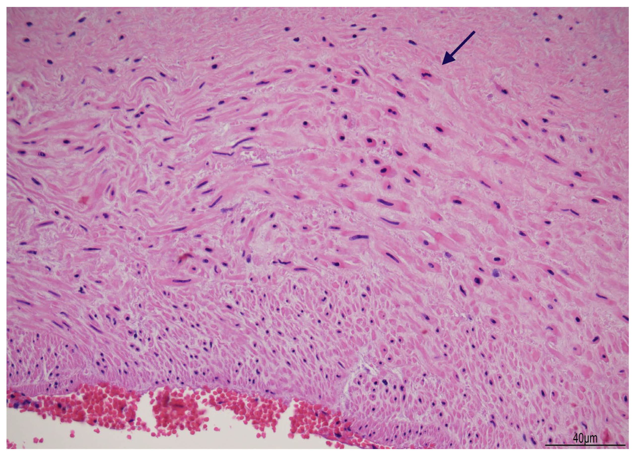 Diagnostics 15 01423 g004 Diagnostics 15 01423 g004