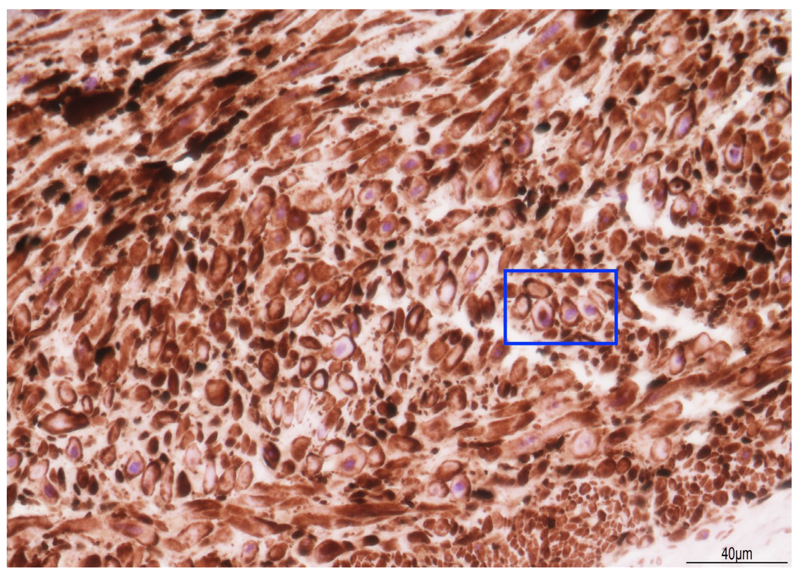 Diagnostics 15 01423 g005 Diagnostics 15 01423 g005