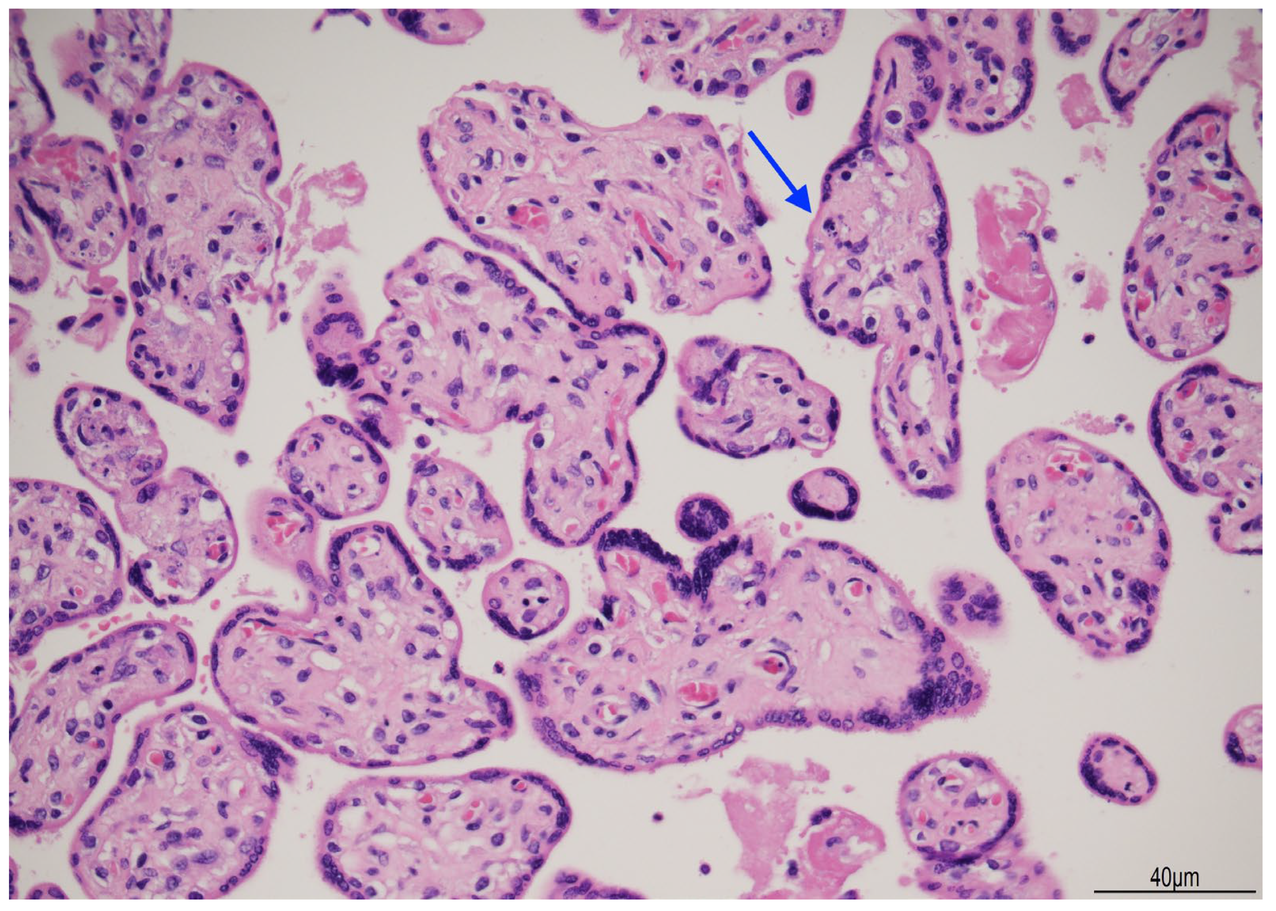 Diagnostics 15 01423 g006 Diagnostics 15 01423 g006