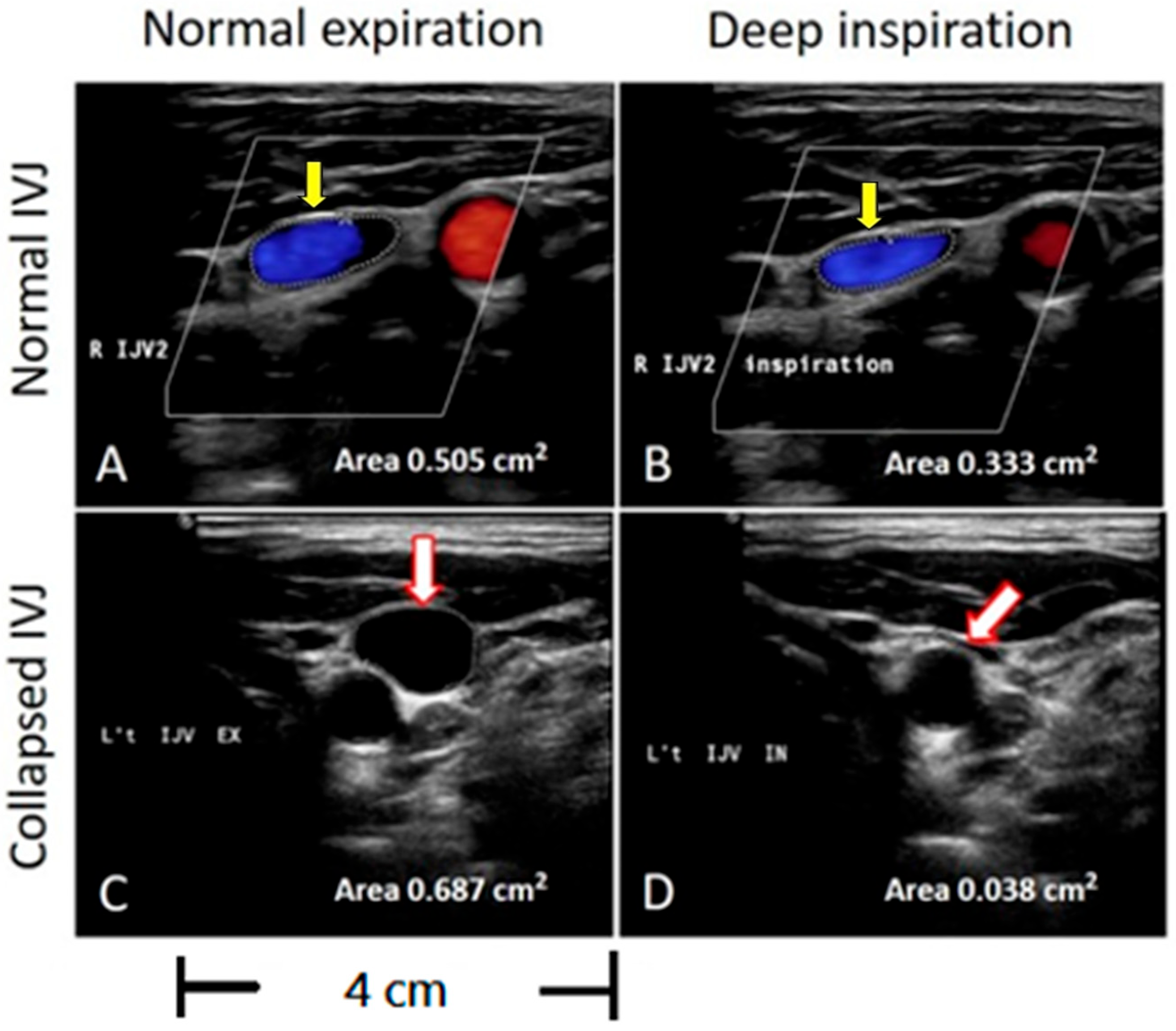 Diagnostics 15 01427 g002