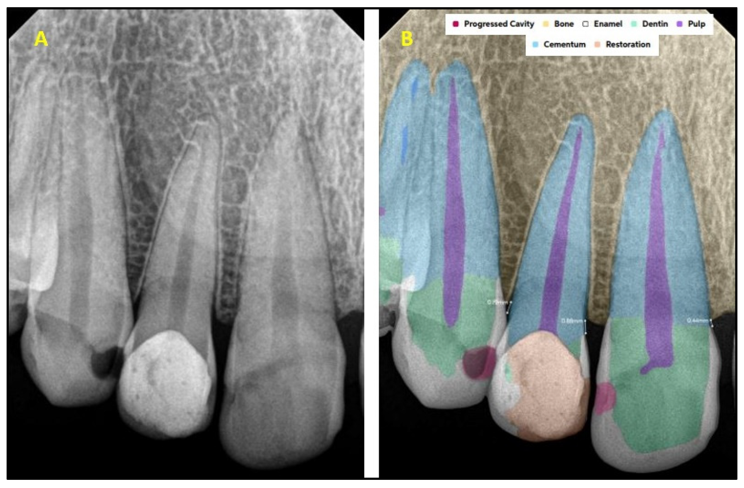 Diagnostics 15 01432 g002