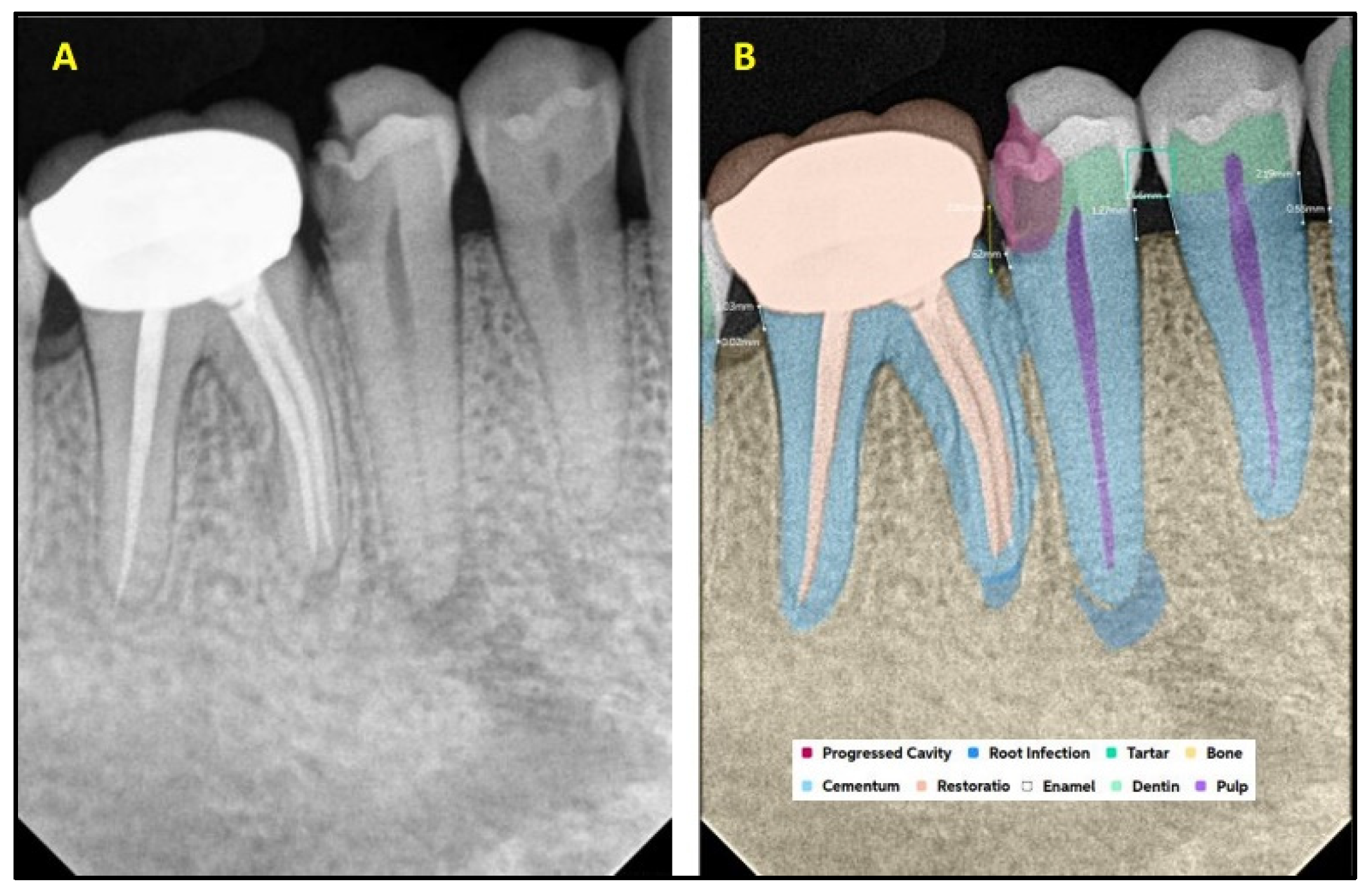 Diagnostics 15 01432 g003