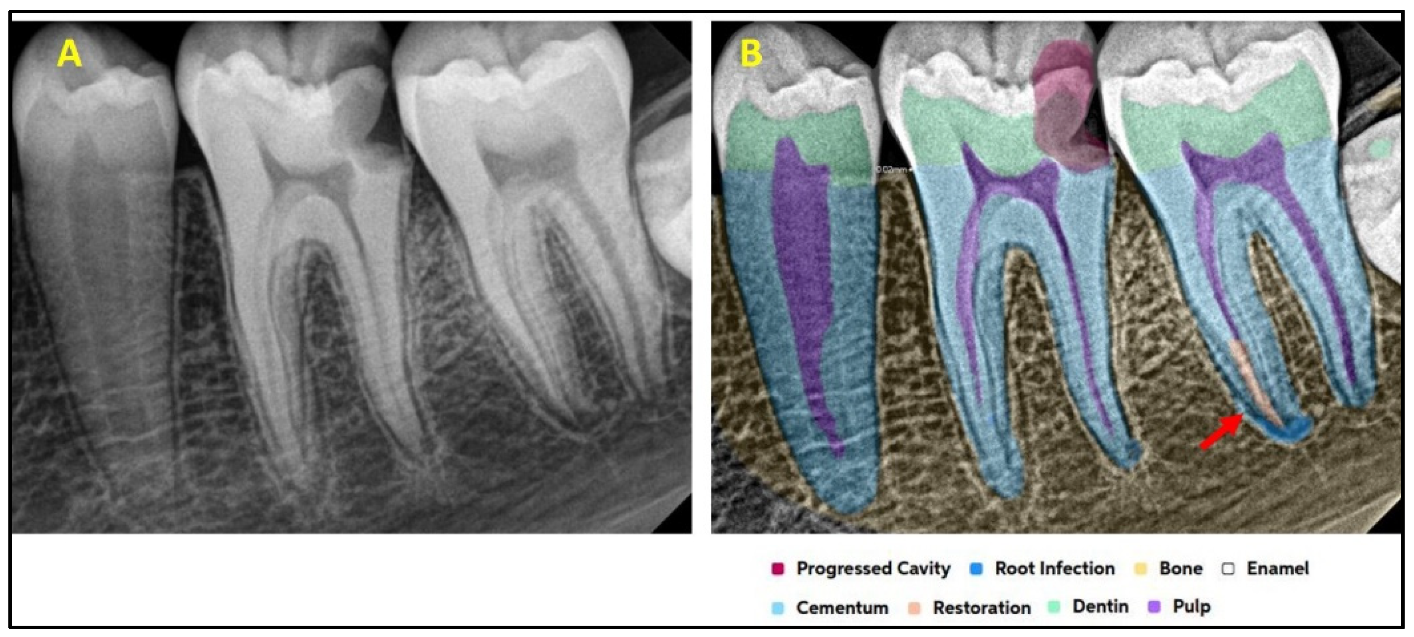Diagnostics 15 01432 g004