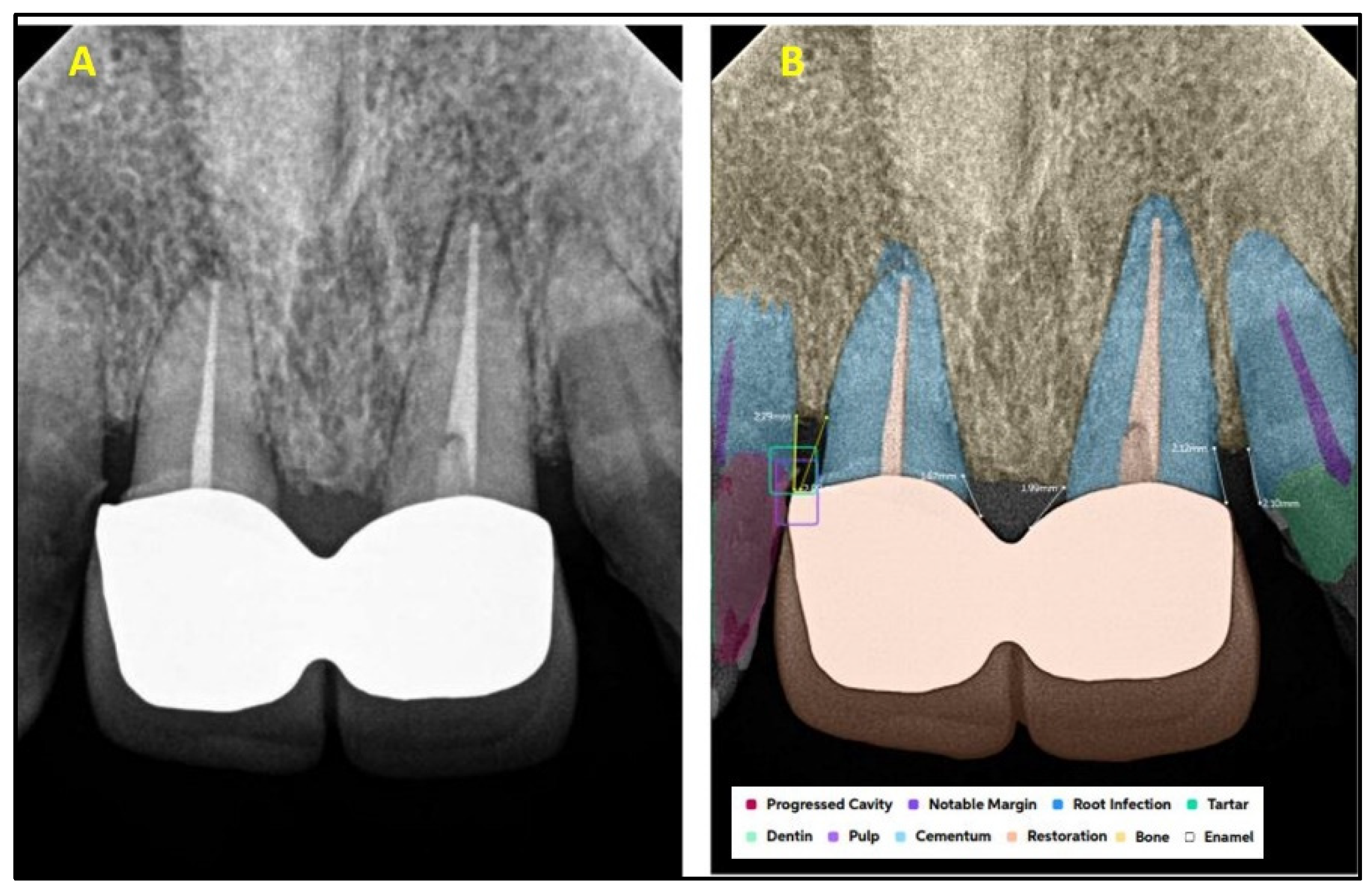 Diagnostics 15 01432 g005
