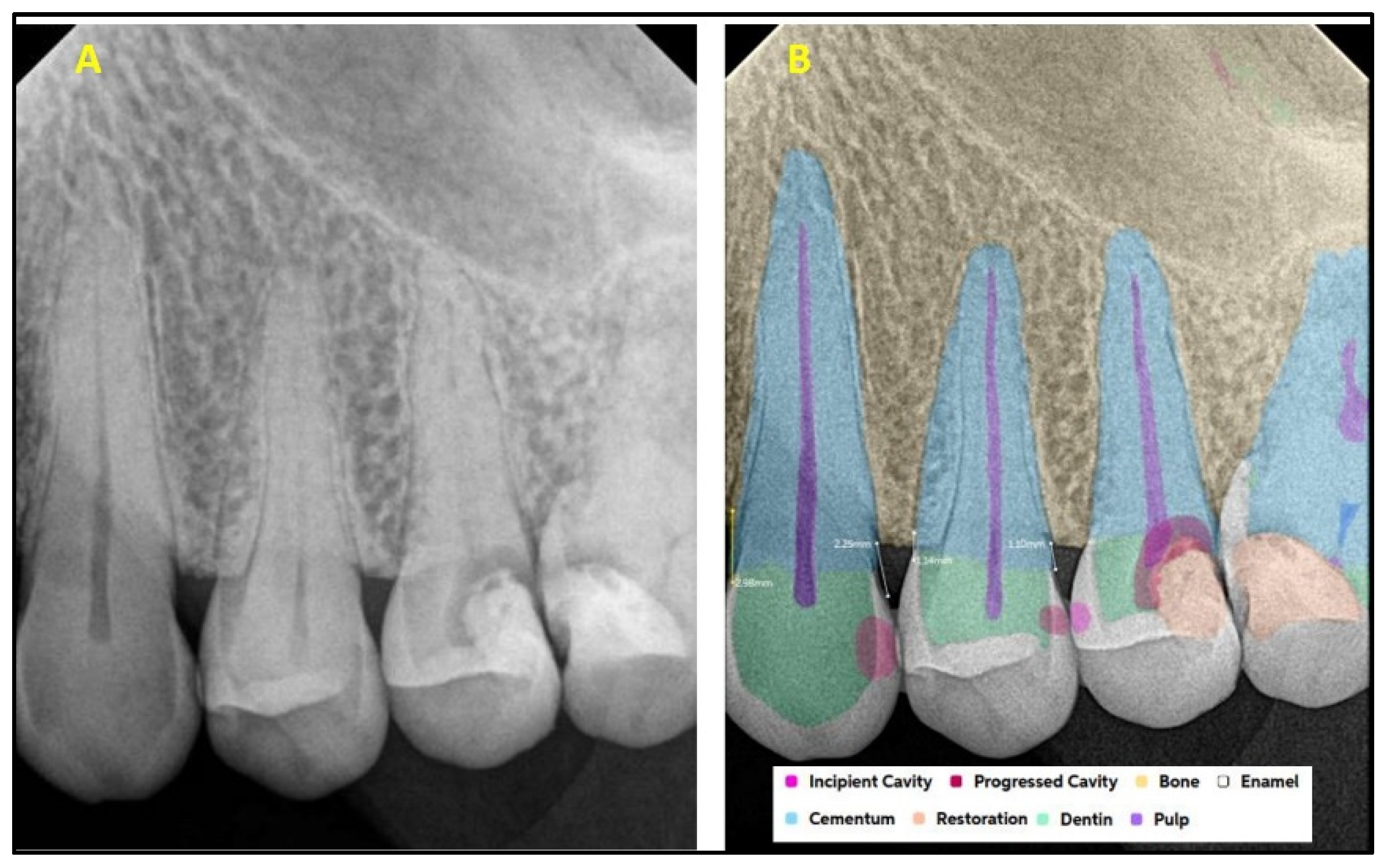 Diagnostics 15 01432 g006