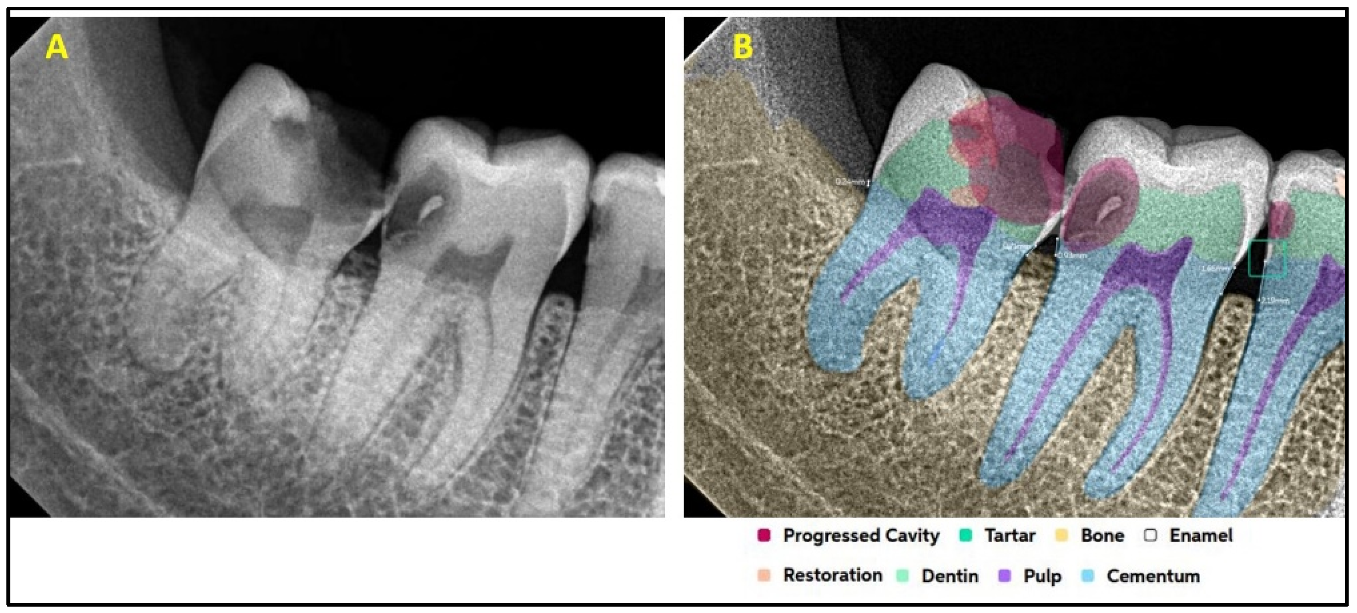 Diagnostics 15 01432 g007