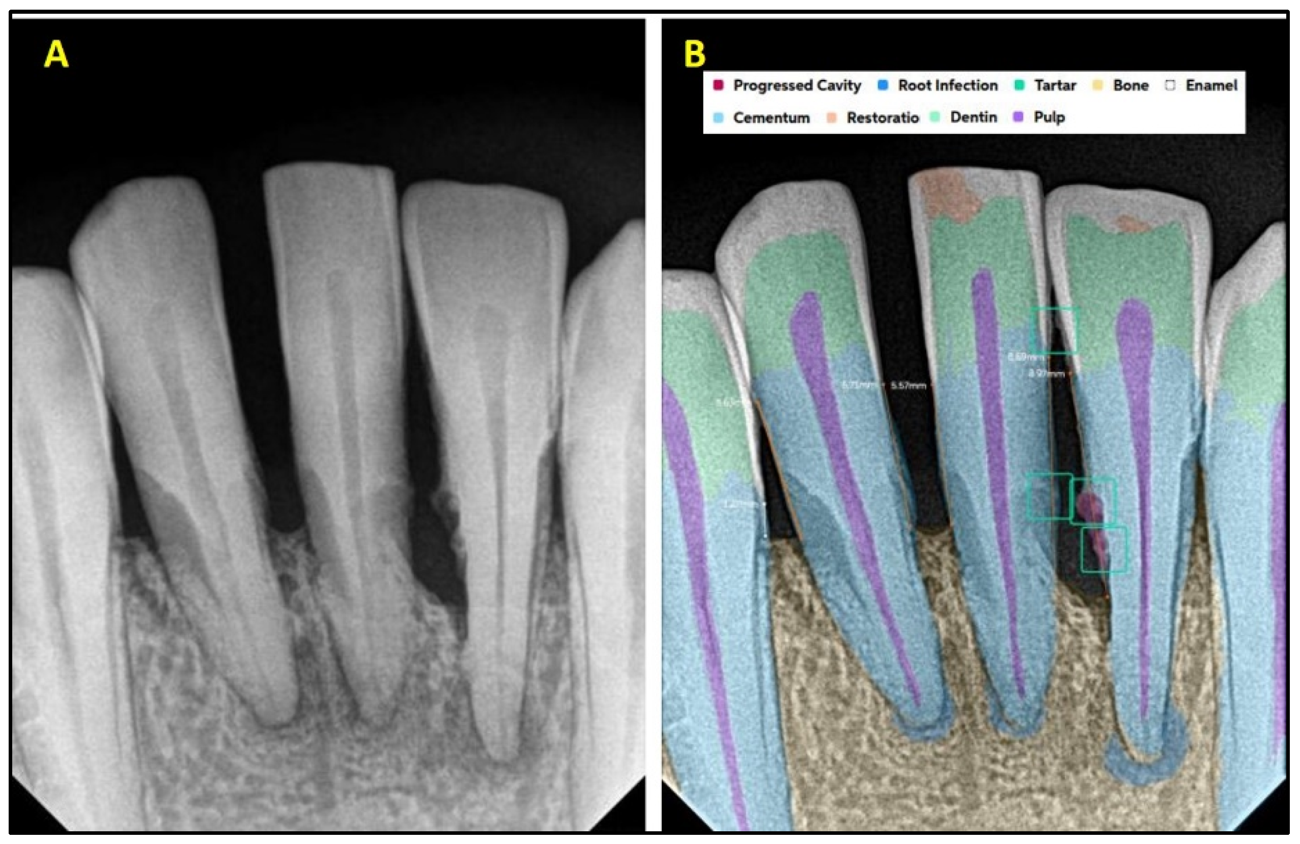 Diagnostics 15 01432 g008
