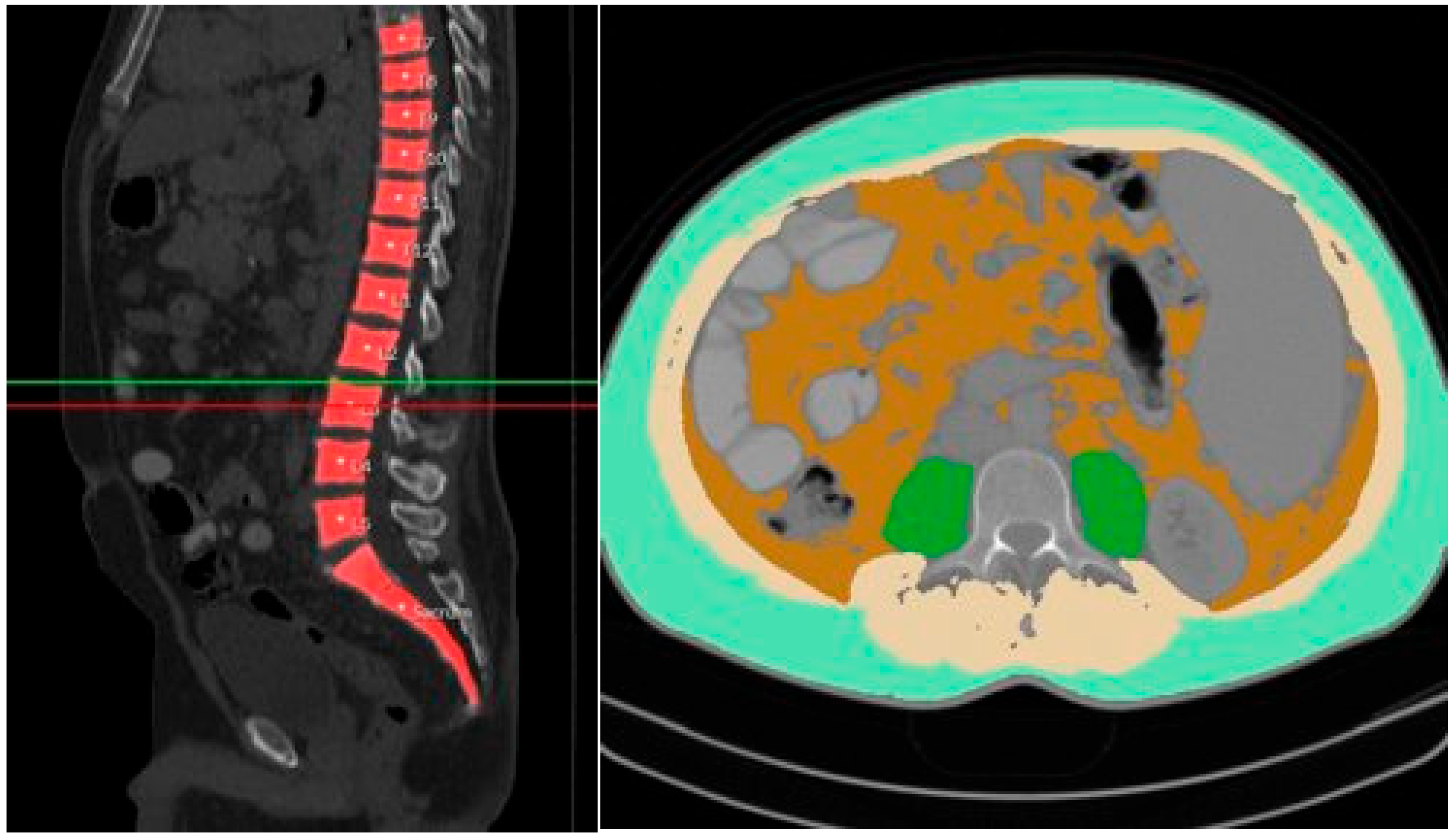 Diagnostics 15 01440 g001