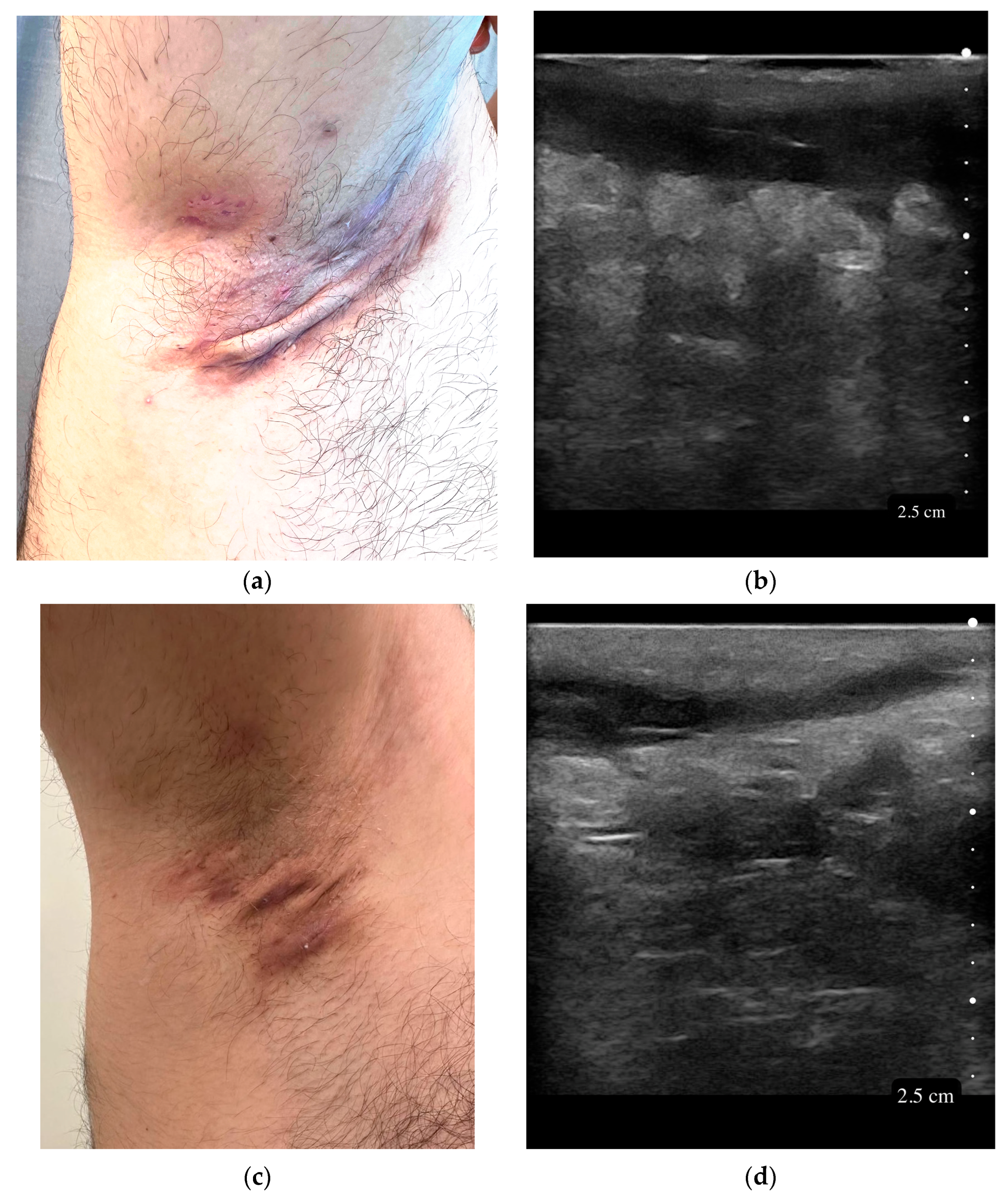 Diagnostics 15 01442 g001