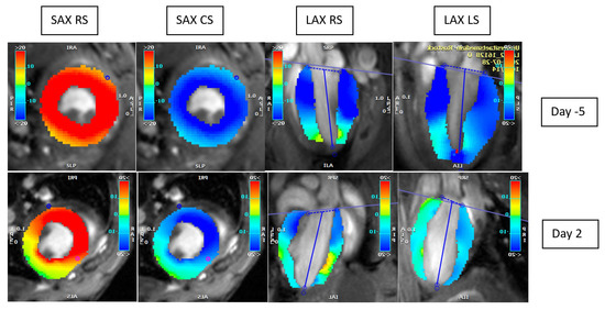 Comparison of Myocardial Function in Young and Old Mice During Acute ...