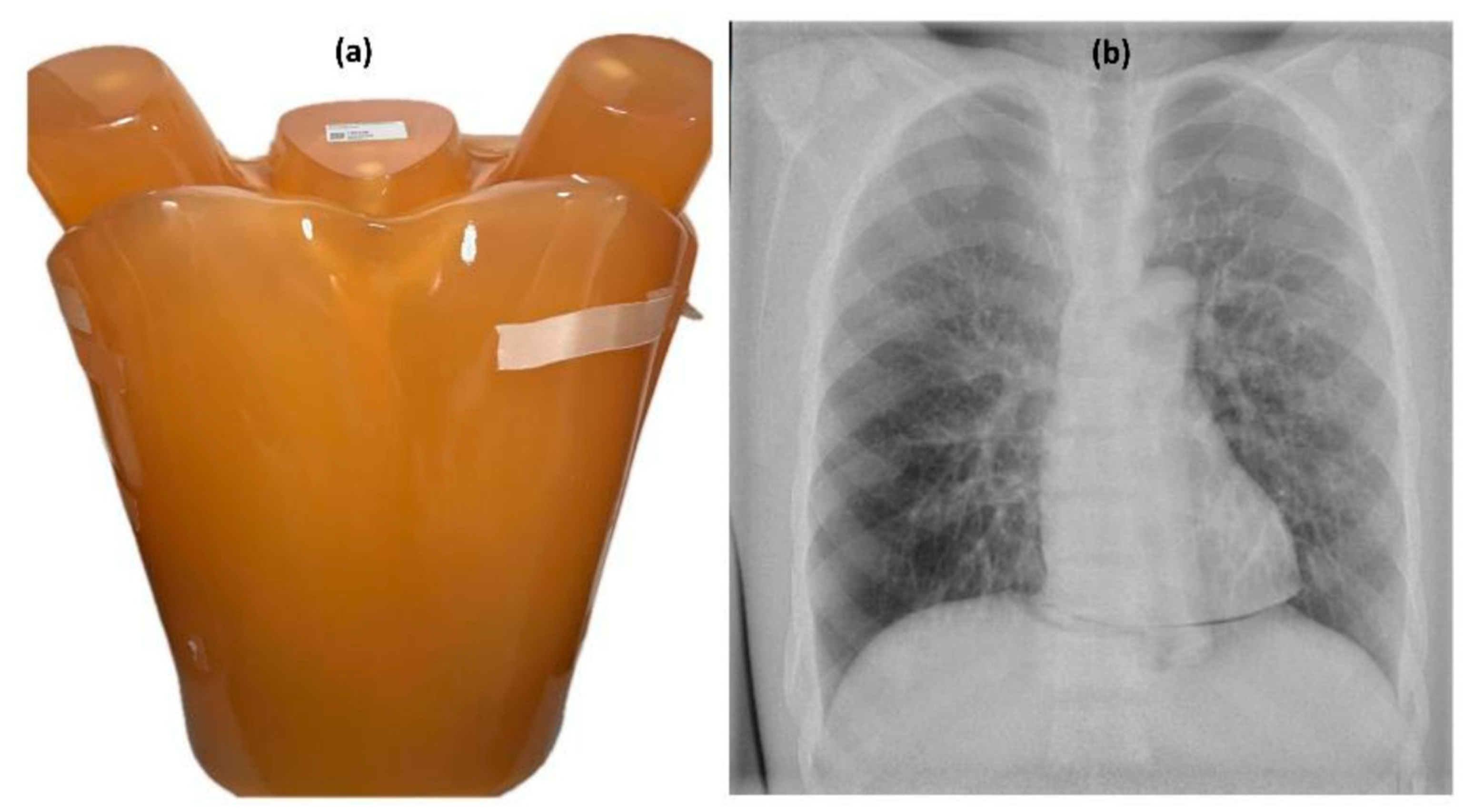 Diagnostics 15 01450 g002