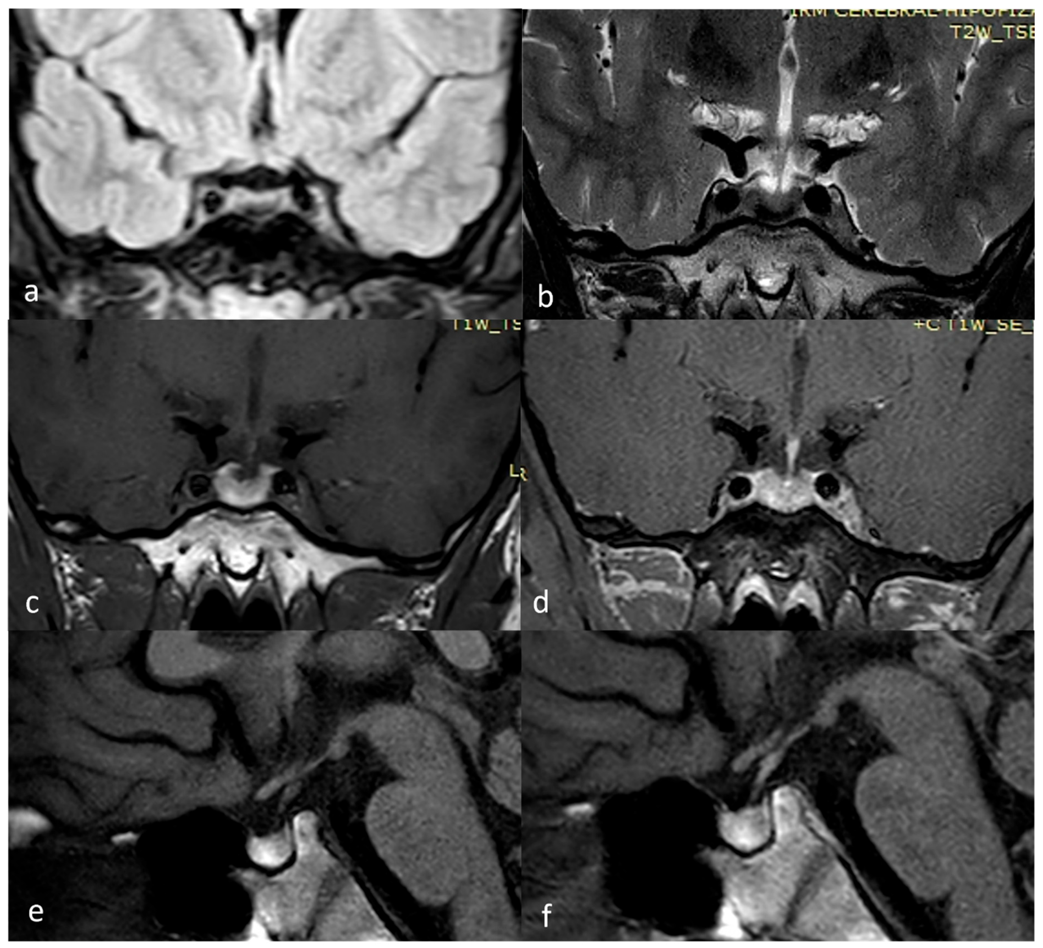 Diagnostics 15 01453 g003 Diagnostics 15 01453 g003