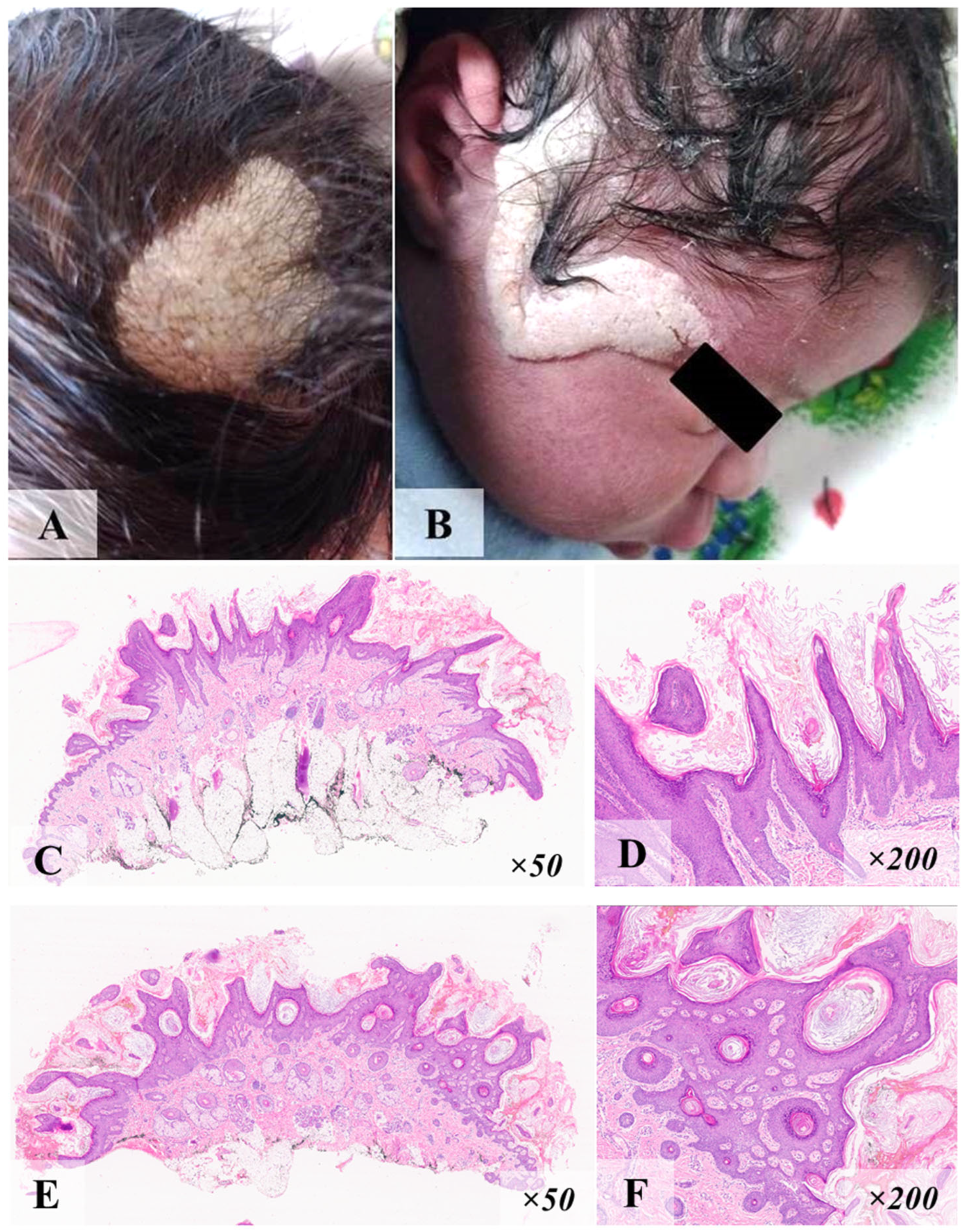 Diagnostics 15 01456 g001